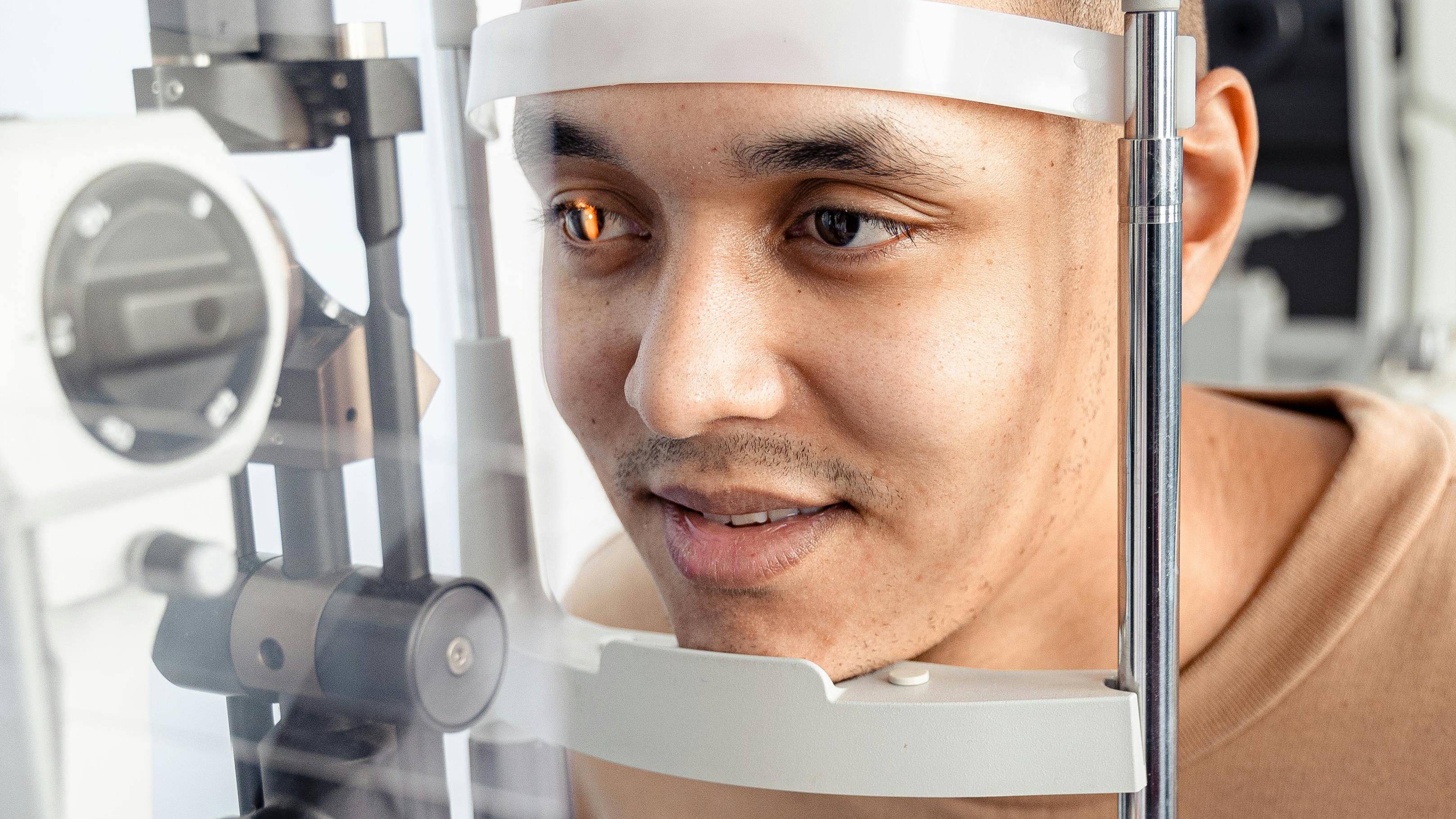 Rách võng mạc xảy ra sau bong dịch kính hoặc chấn thương, có thể tiến triển thành bong võng mạc