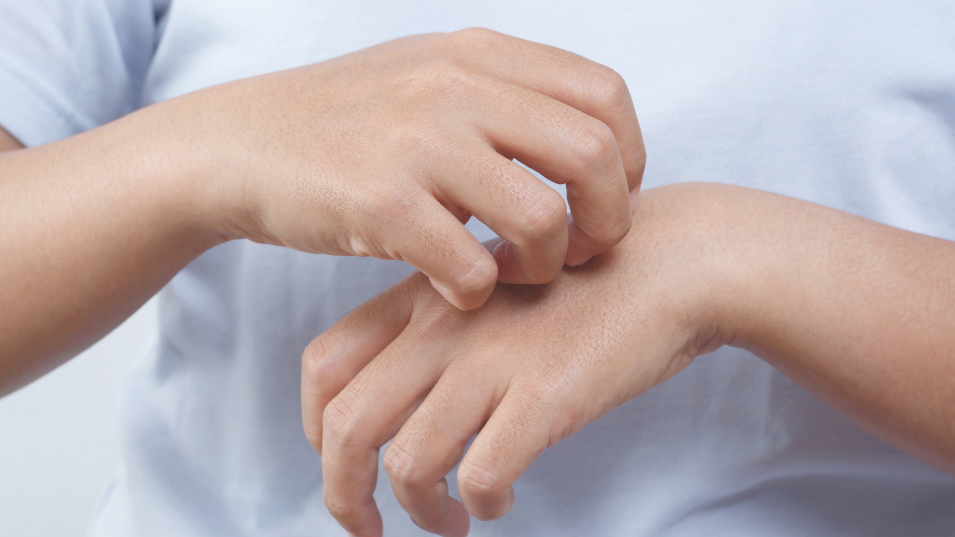 Người bệnh thường ngứa nhẹ lúc đầu, sau đó ngứa tăng dần và rõ hơn vào ban đêm khi ký sinh trùng hoạt động mạnh