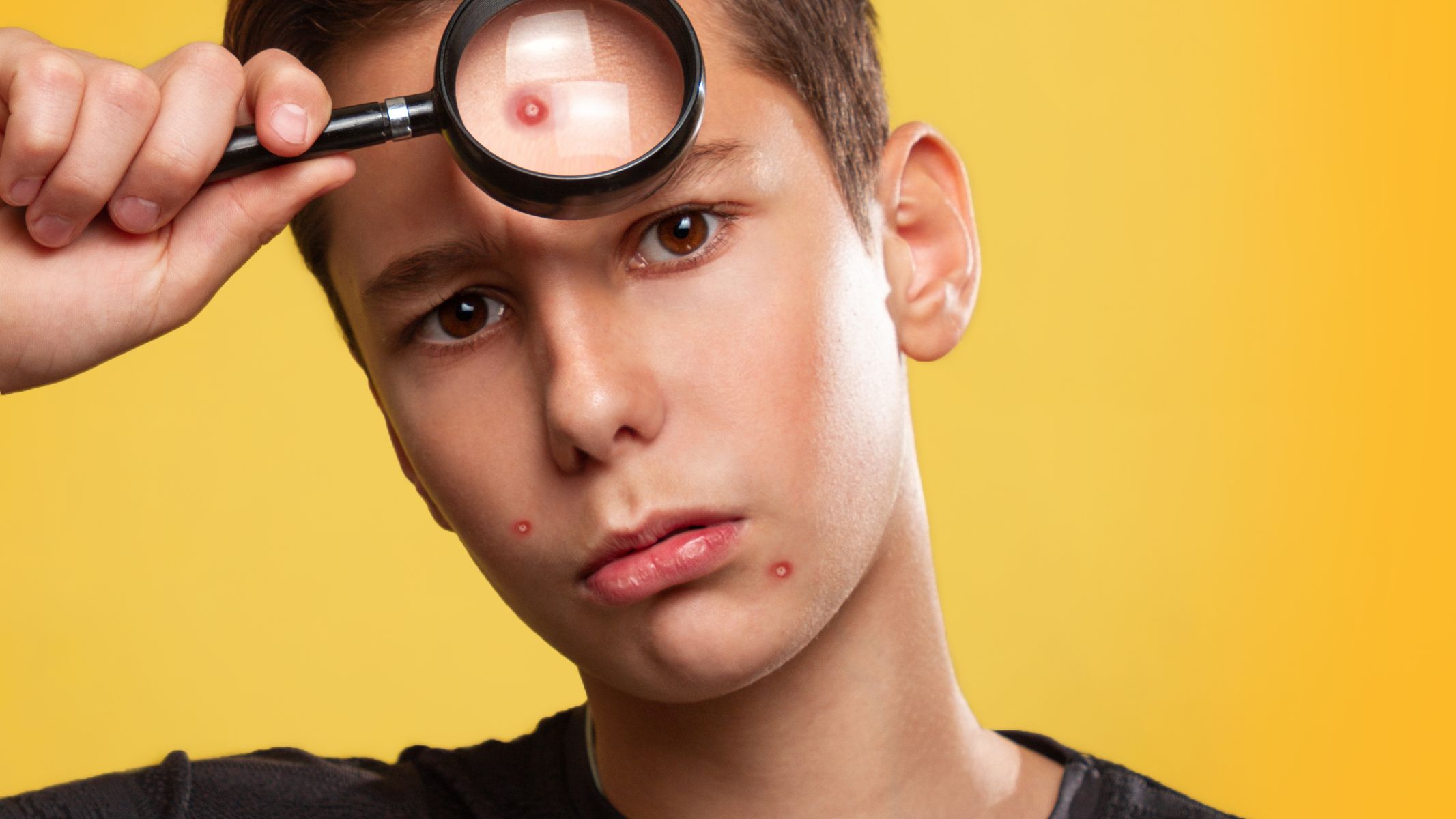 Các giai đoạn dậy thì ở nam và nữ không diễn ra giống nhau