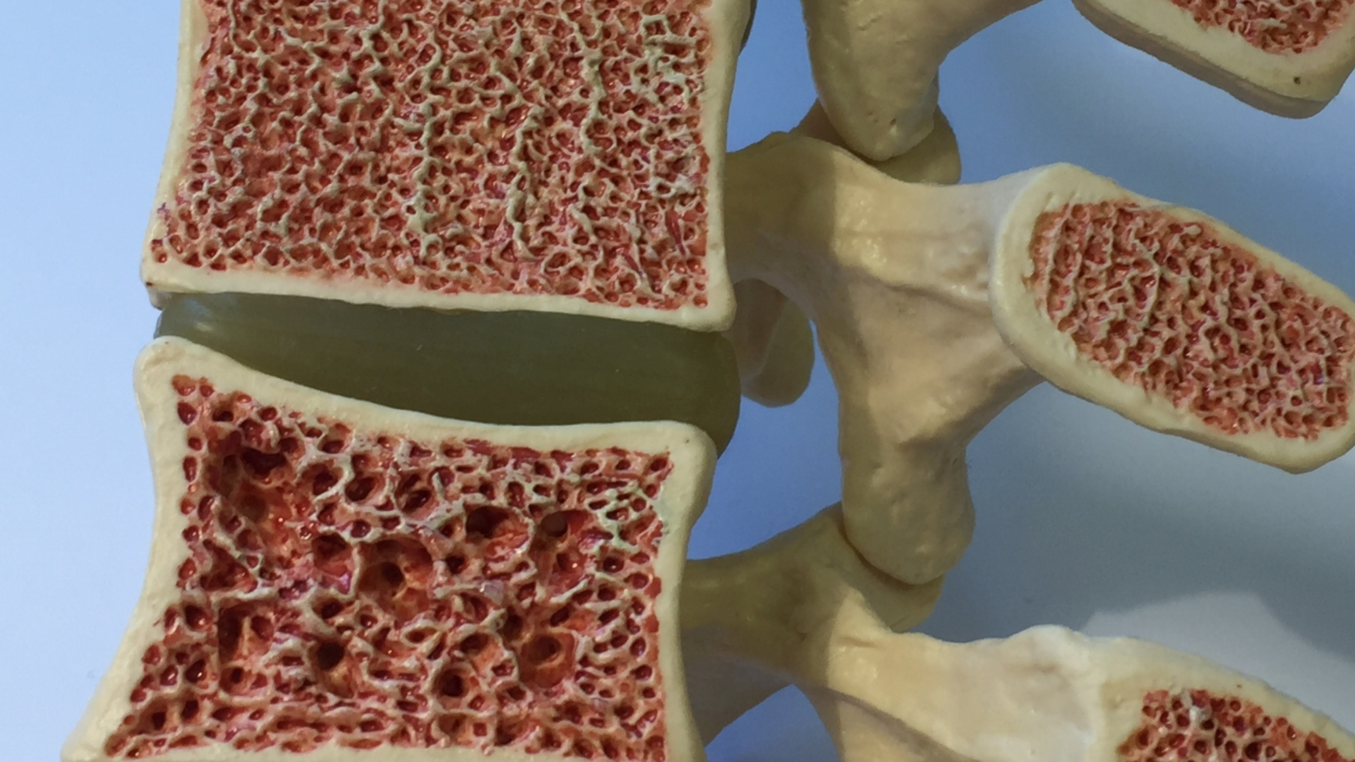 Các loại cá giàu canxi sẽ hỗ trợ cải thiện mật độ xương và tăng hiệu quả điều trị loãng xương