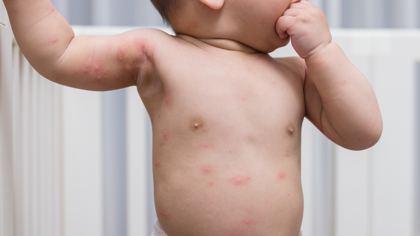 Khi nghi ngờ bé bị dị ứng với một loại hạt nào đó, cha mẹ nên đưa con đến gặp bác sĩ