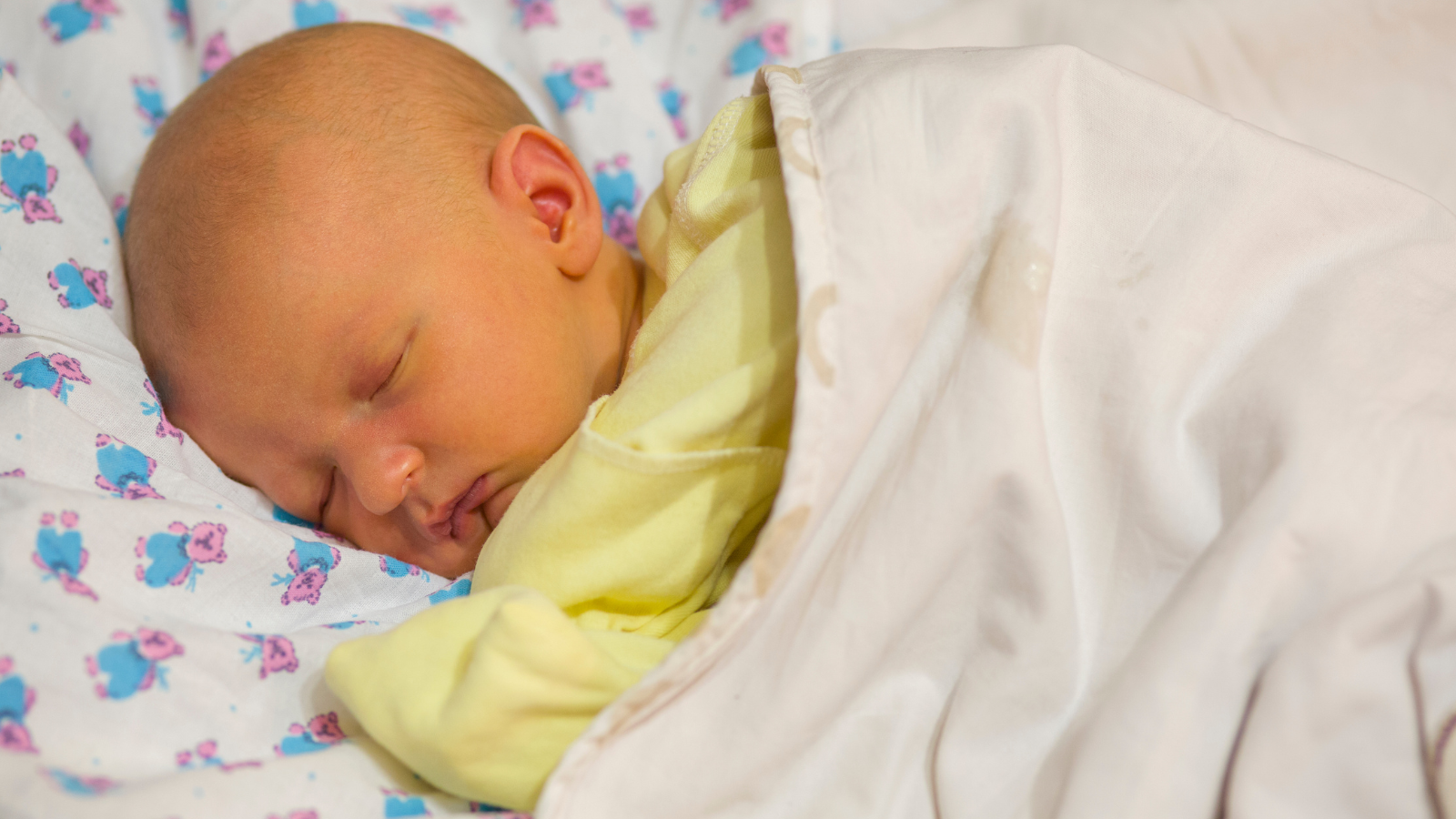 Quan sát màu sắc da của trẻ