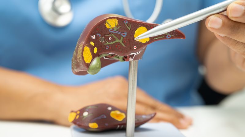 Các loại viêm gan do virus gây ra có thể gây viêm và suy giảm chức năng gan