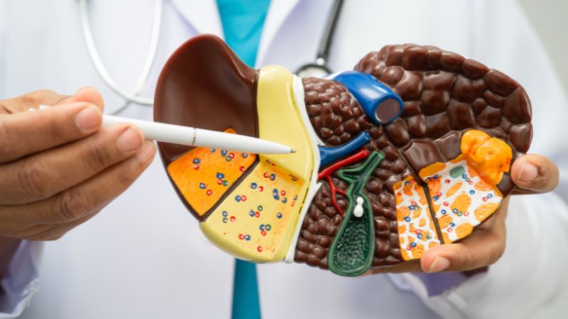 Viêm gan do virus tiến triển âm thầm và gây nhiều tổn thương gan nghiêm trọng