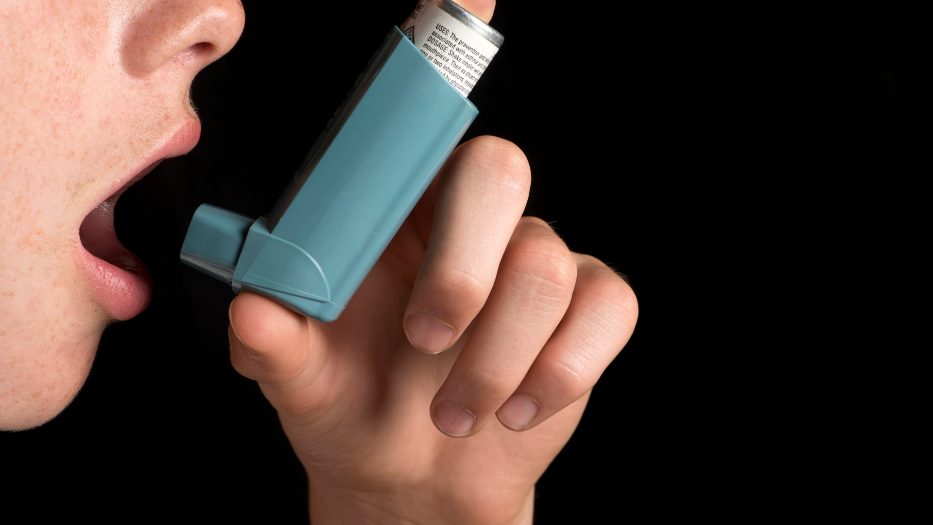 Các triệu chứng của viêm mũi dị ứng và biện pháp phòng ngừa 4
