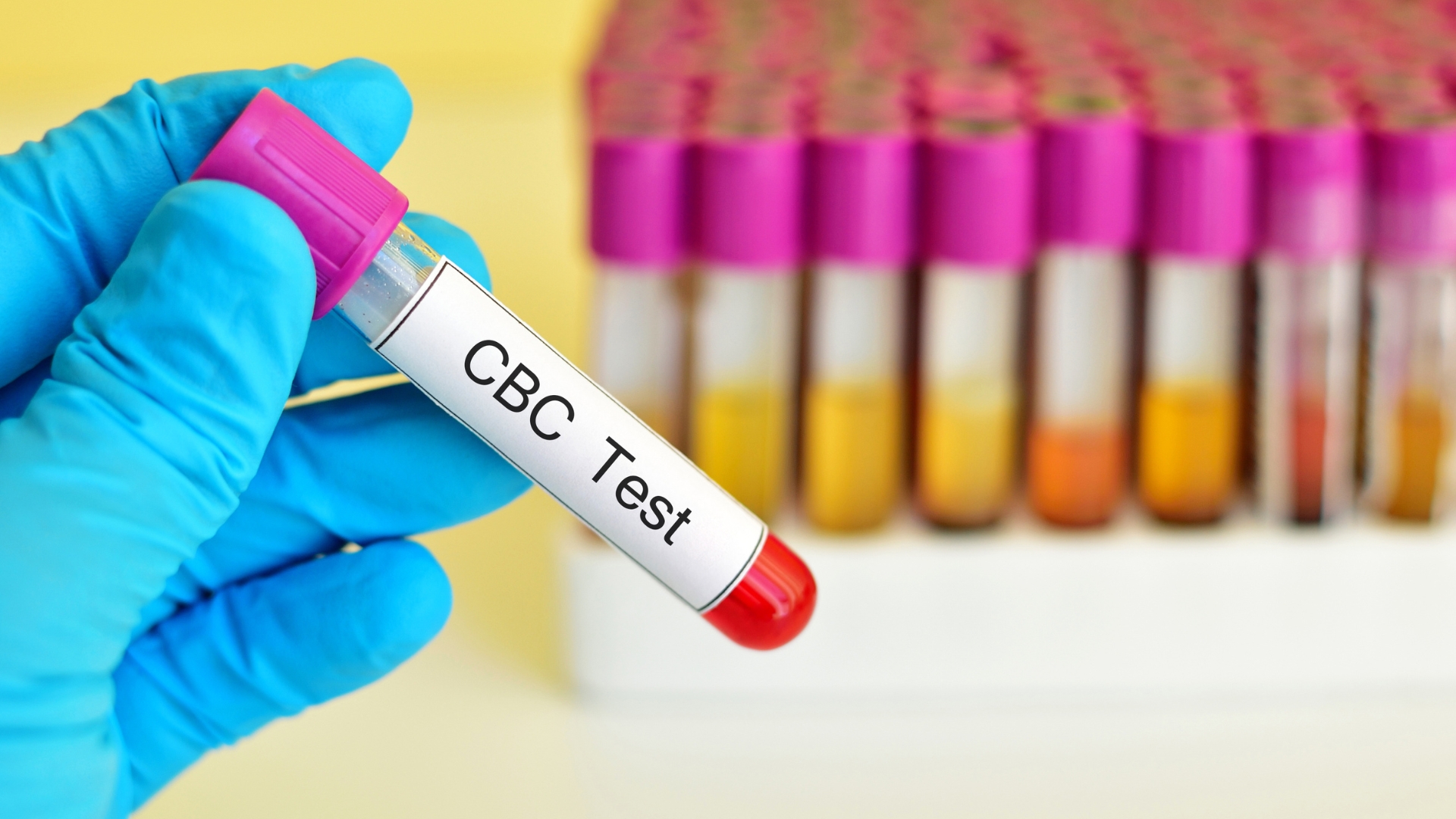 cac-xet-nghiem-mau-thuong-dung-trong-chan-doan-xet-nghiem-lupus-ban-do-3.jpg