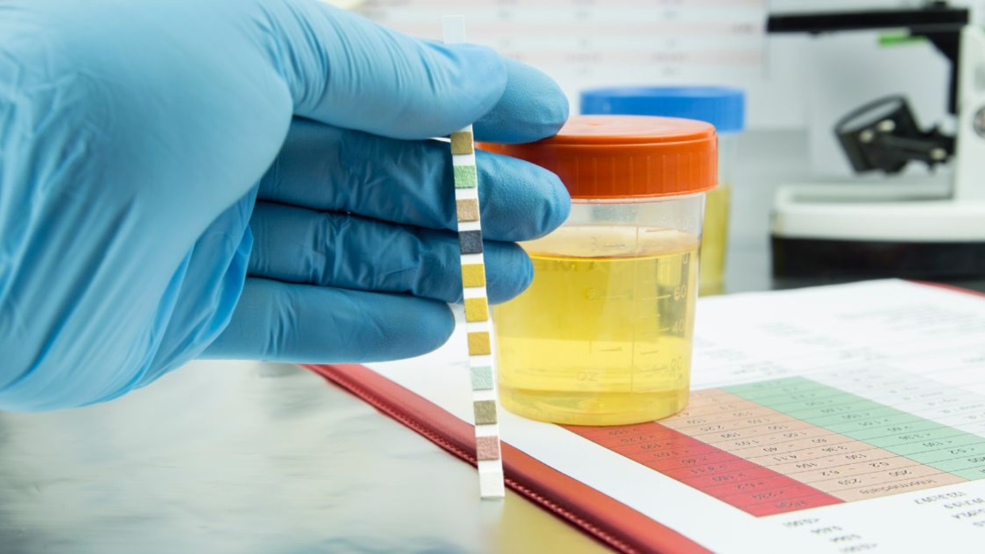 Xét nghiệm tổng phân tích nước tiểu là bước quan trọng trong kiểm tra sức khỏe định kỳ