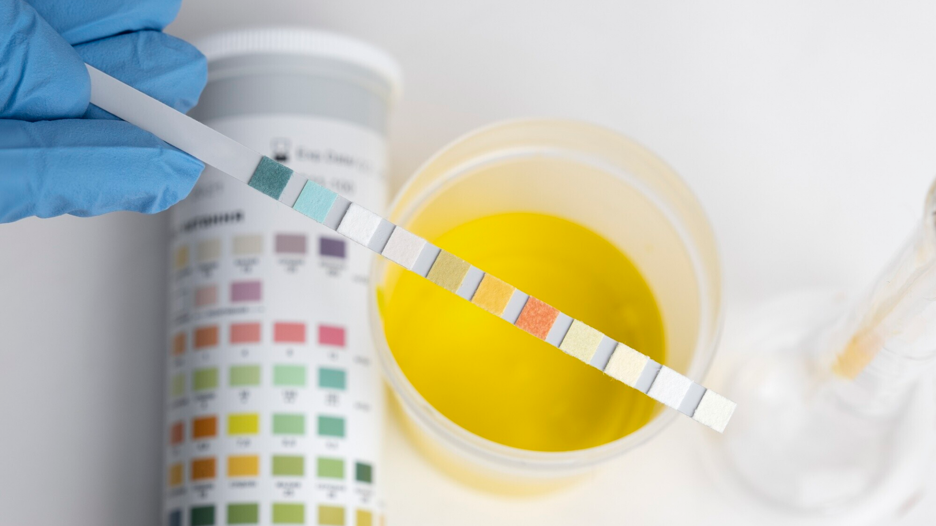 Nắm rõ giá trị pH giúp bạn nhận biết sớm bất thường trong hoạt động của thận và hệ tiết niệu