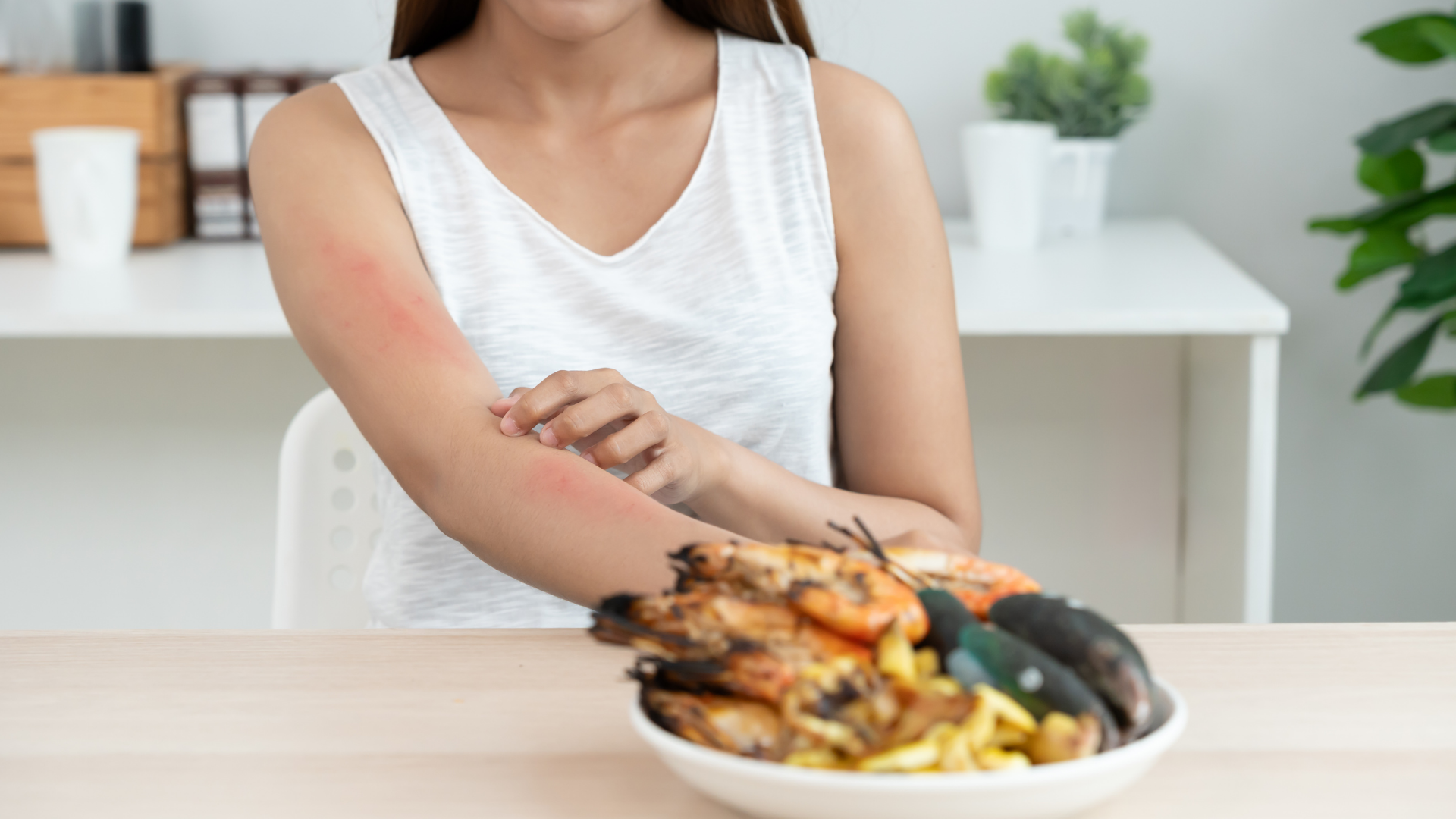 Dị ứng hải sản khiến da ngứa nổi mẩn, do hệ miễn dịch phản ứng quá mức