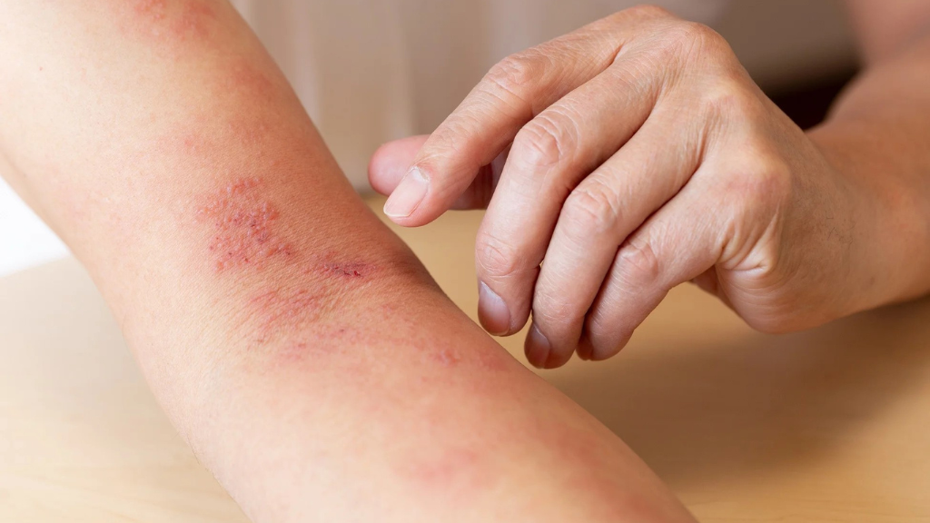 cach-chua-zona-than-kinh-an-toan-va-hieu-qua-tai-nha 1.png