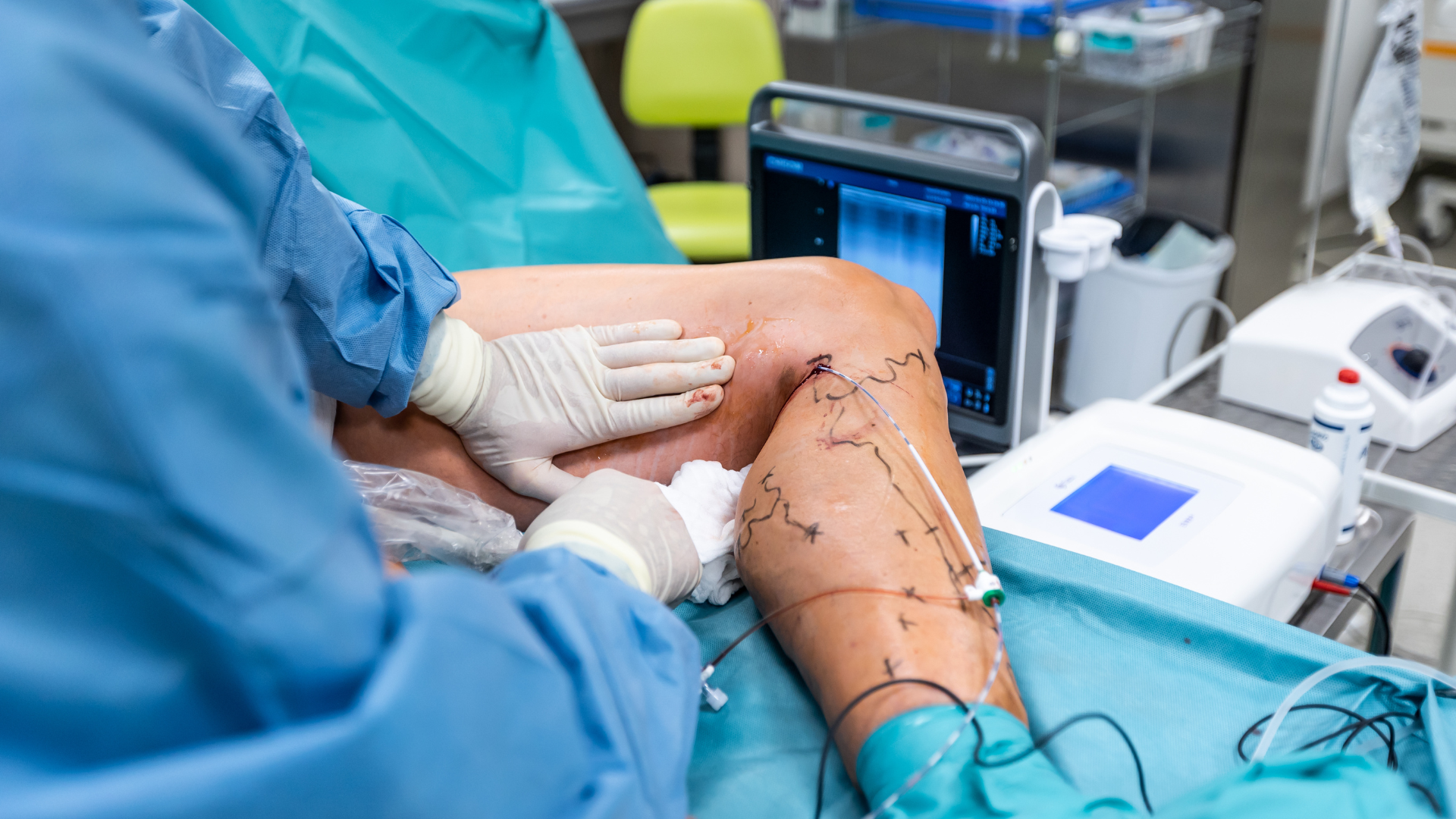 Khám sớm giúp lựa chọn cách điều trị giãn tĩnh mạch phù hợp với từng trường hợp