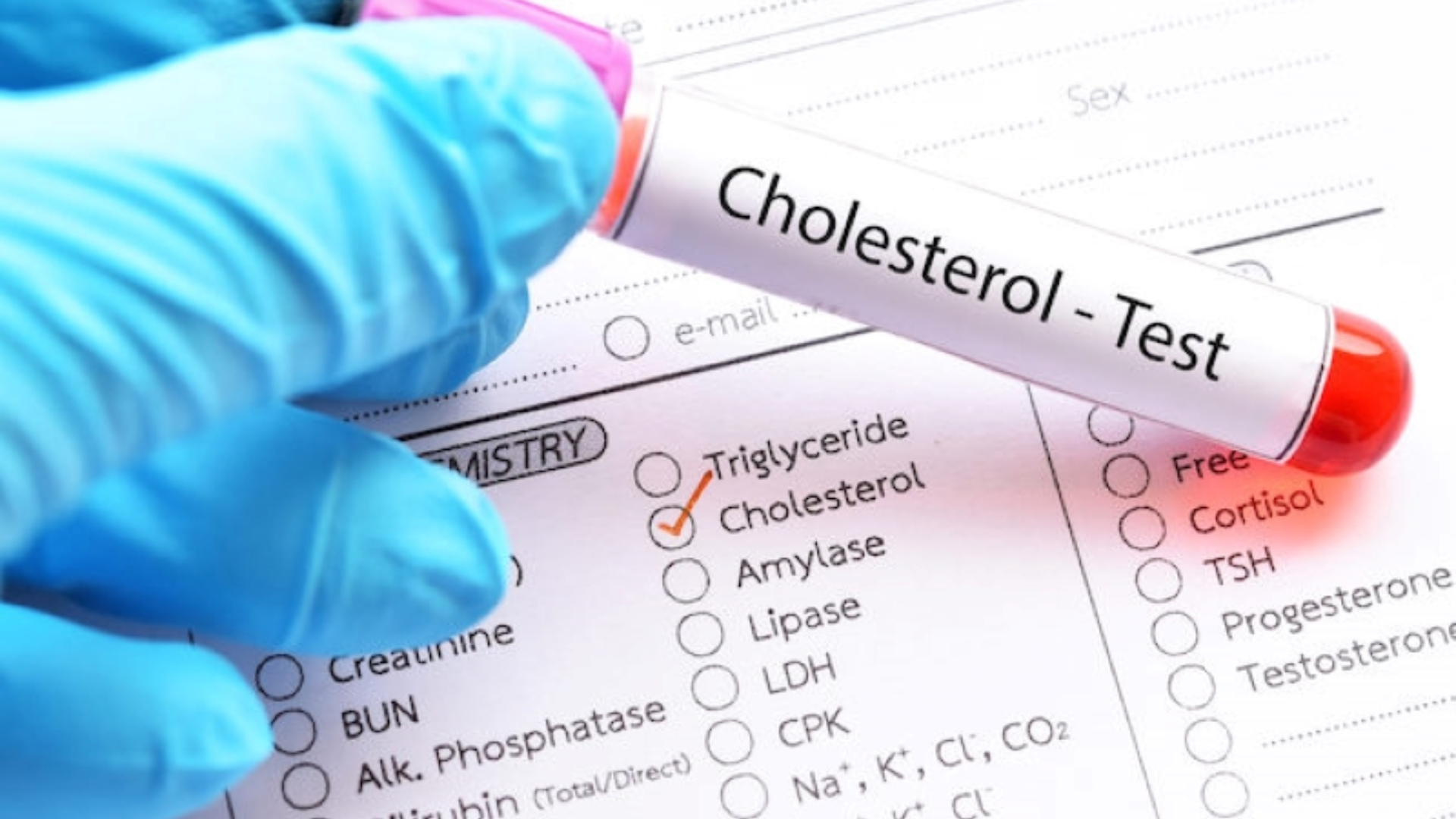 Biết cách đọc chỉ số cholesterol giúp bạn kiểm soát mỡ máu, bảo vệ tim và cải thiện thói quen sống