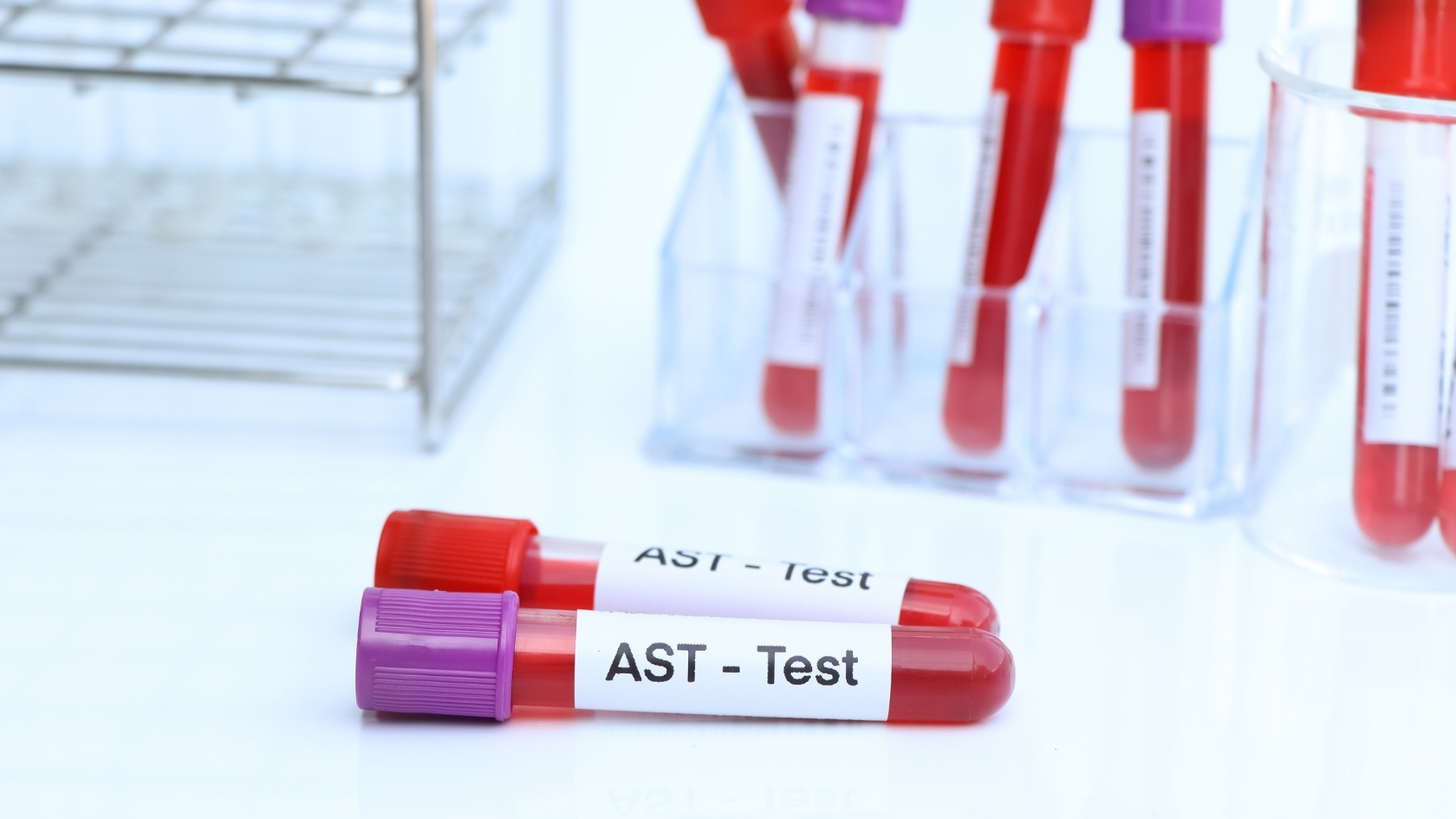 AST tham gia chuyển hóa amino acid trong gan, cơ tim và cơ xương