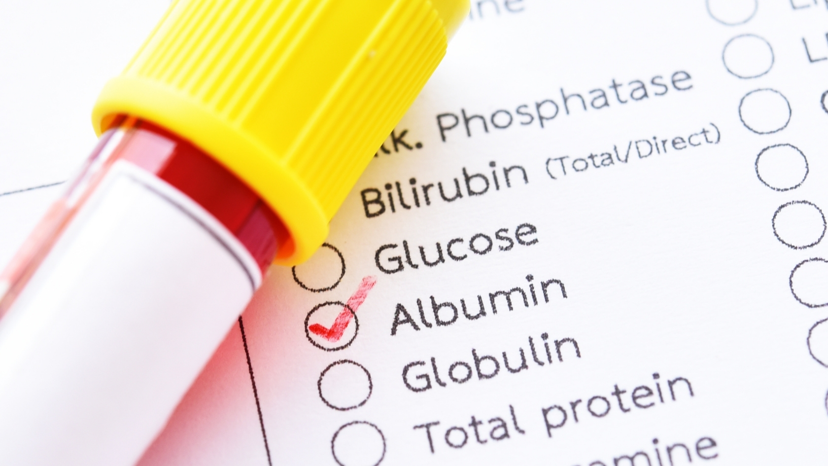 Albumin là loại protein chiếm tỷ lệ cao nhất trong huyết tương, được gan tổng hợp, giúp duy trì áp suất keo và vận chuyển nhiều chất