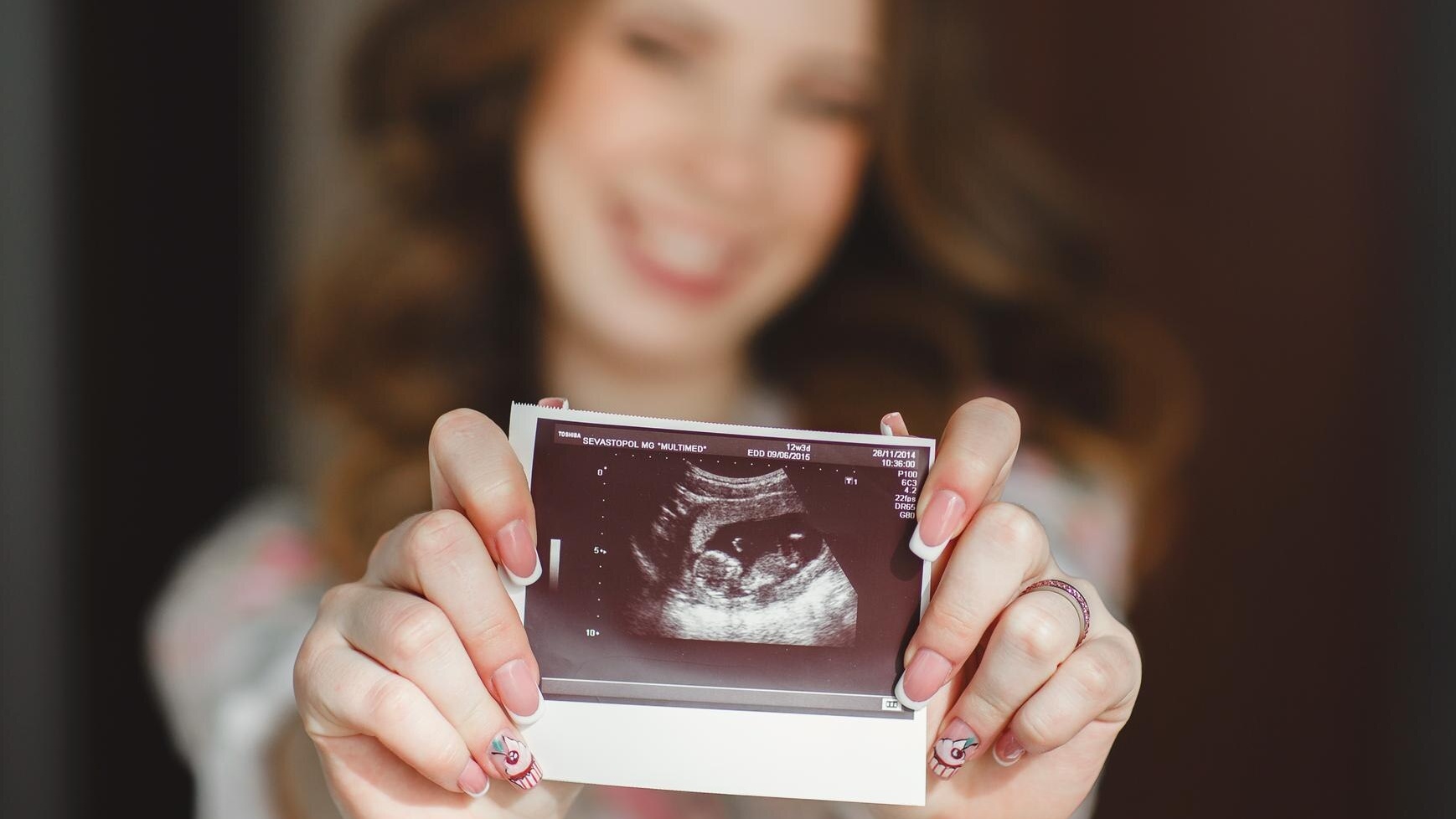 NIPT chỉ là xét nghiệm sàng lọc, không thay thế cho xét nghiệm chẩn đoán