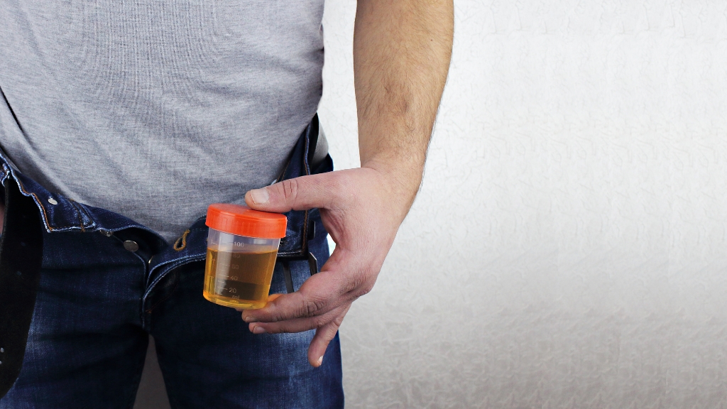 Lấy mẫu nước tiểu đúng quy trình giúp đảm bảo độ chính xác của kết quả xét nghiệm