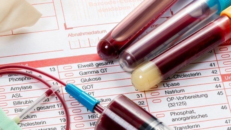 Sự mất cân bằng điện giải gây rối loạn nhịp tim