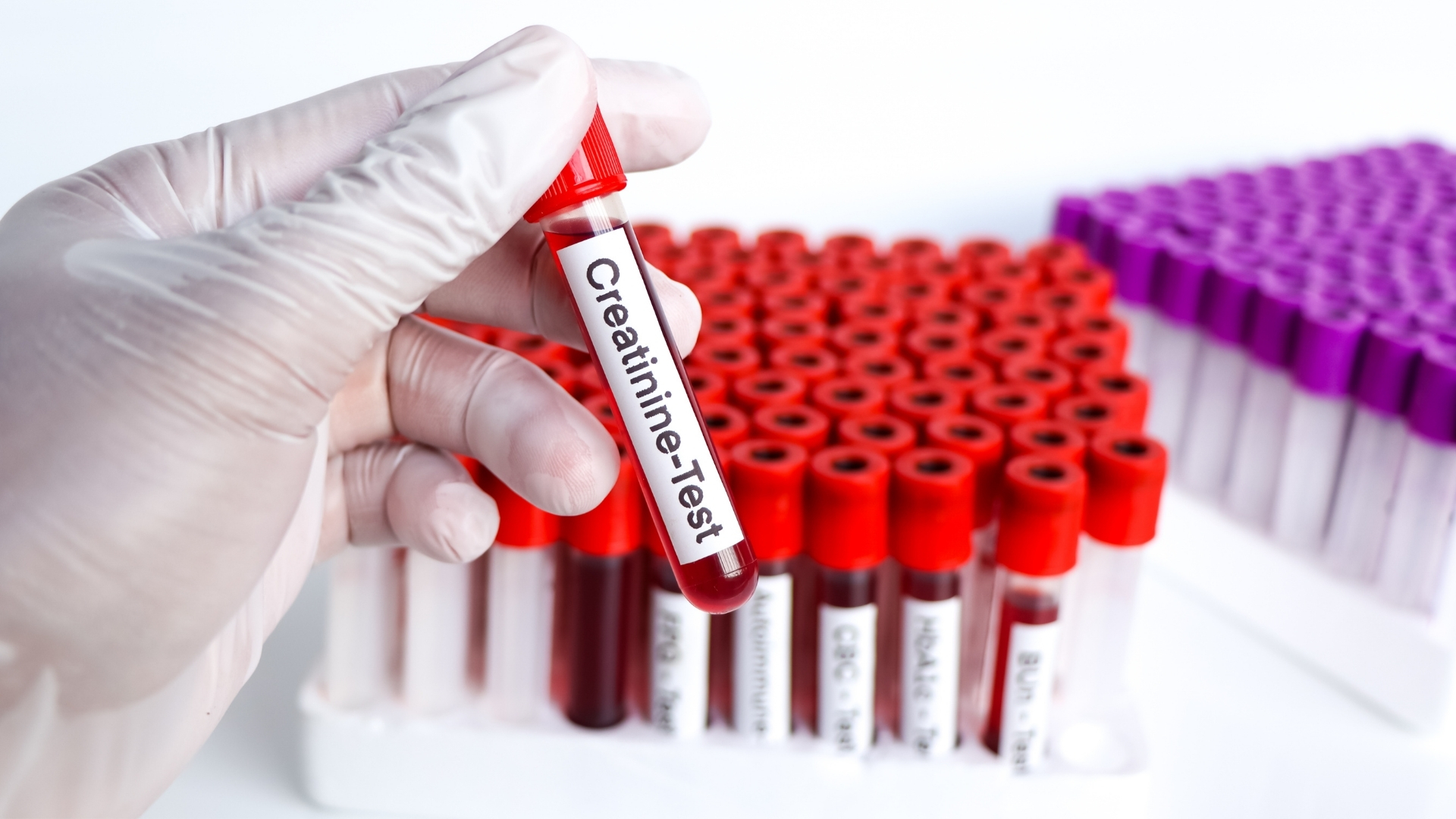 Kiểm tra chỉ số creatinin định kỳ giúp phát hiện sớm những bất thường và theo dõi hiệu quả của các biện pháp điều trị