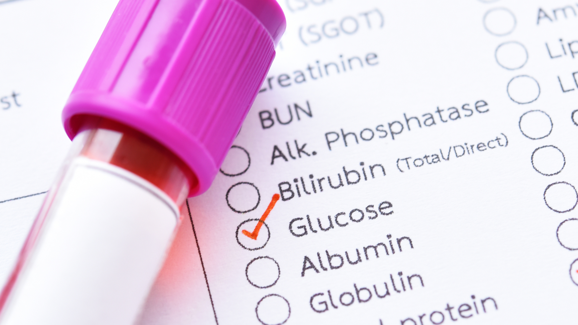 Các chỉ số thường được áp dụng cho xét nghiệm đo đường huyết lúc đói, phải nhịn ăn qua đêm ít nhất 8 tiếng