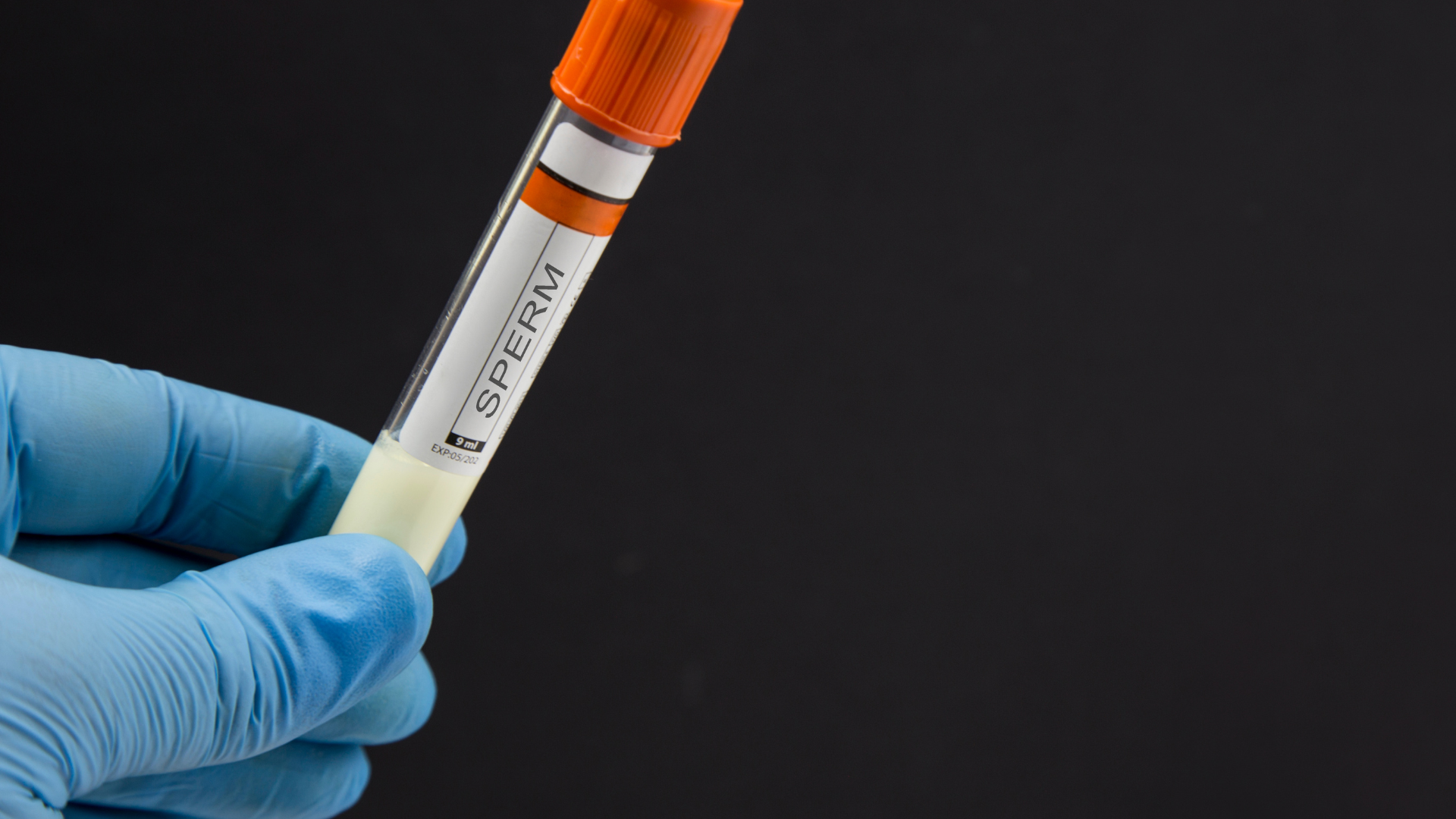 Đừng trì hoãn thăm khám khi nghi ngờ tinh trùng yếu kéo dài