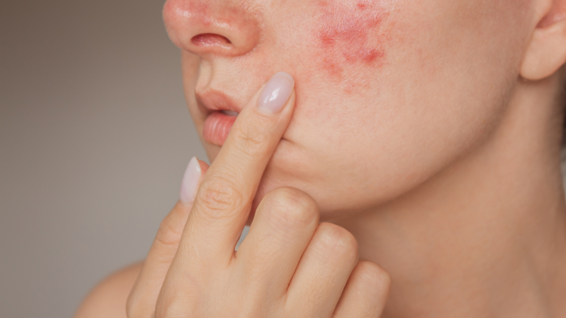 Skincare ban đêm hỗ trợ cách làm xẹp mụn sưng đỏ sau 1 đêm