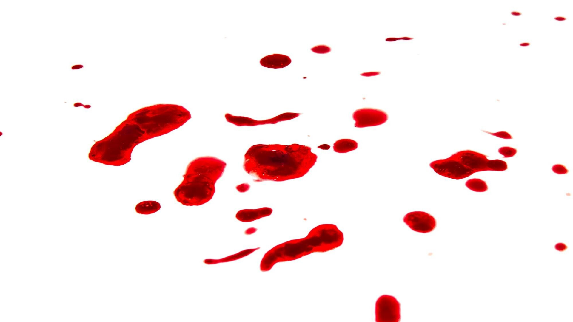 Khi có vết thương hở hoặc phải chăm sóc người khác, bạn cần cẩn trọng khi xử lý vết thương và tiếp xúc với máu