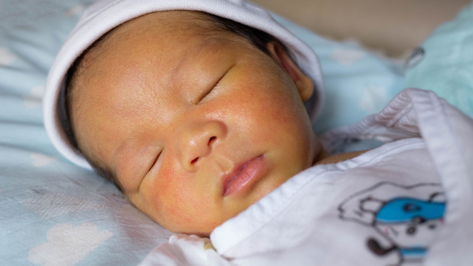 Vàng da là một hiện tượng khá thường gặp ở trẻ sơ sinh