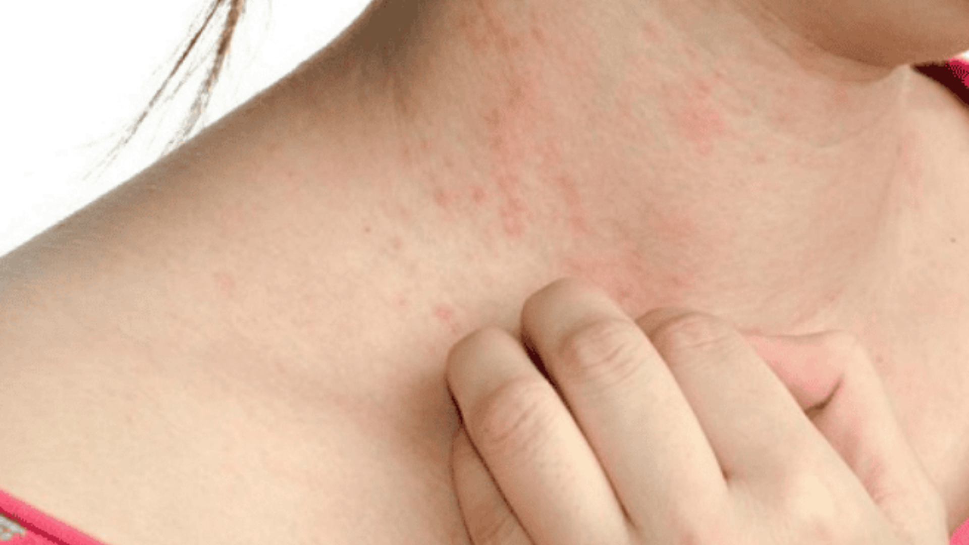 Cách tăng tiểu cầu khi bị sốt xuất huyết an toàn và hiệu quả tại nhà 2