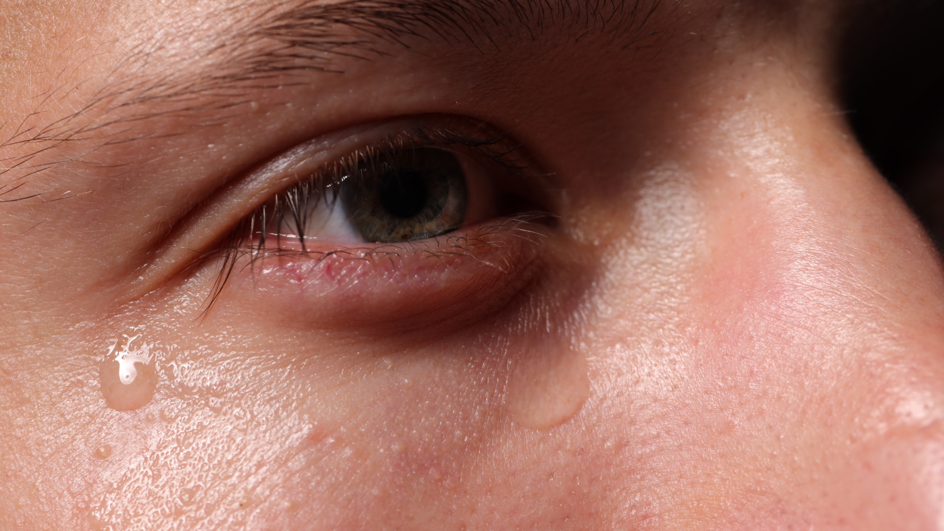 Hạn chế đeo kính áp tròng có thể giúp hạn chế tình trạng khô mắt