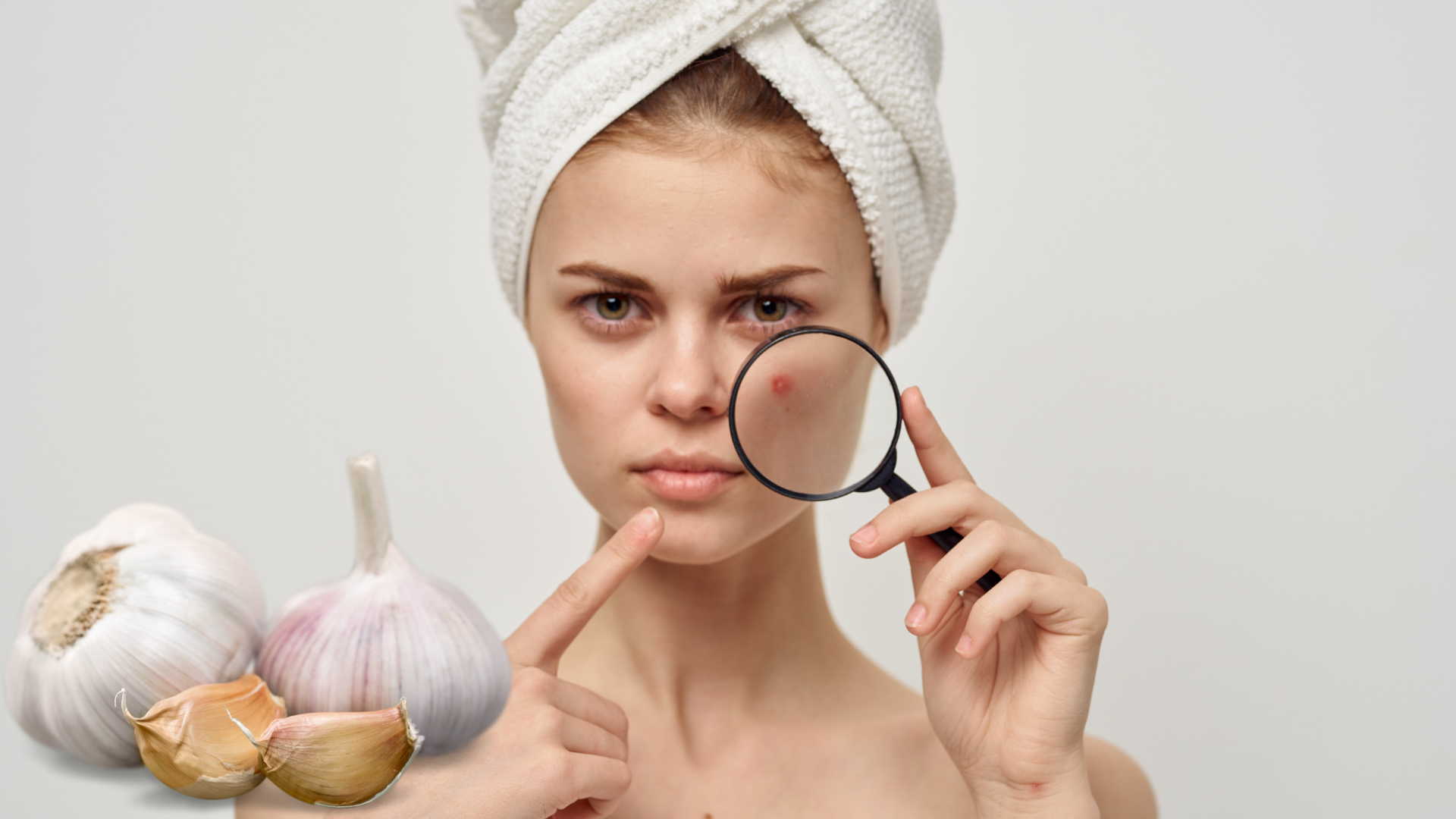 Cách trị mụn nhọt bằng tỏi: Hiểu đúng để sử dụng hiệu quả và an toàn 1