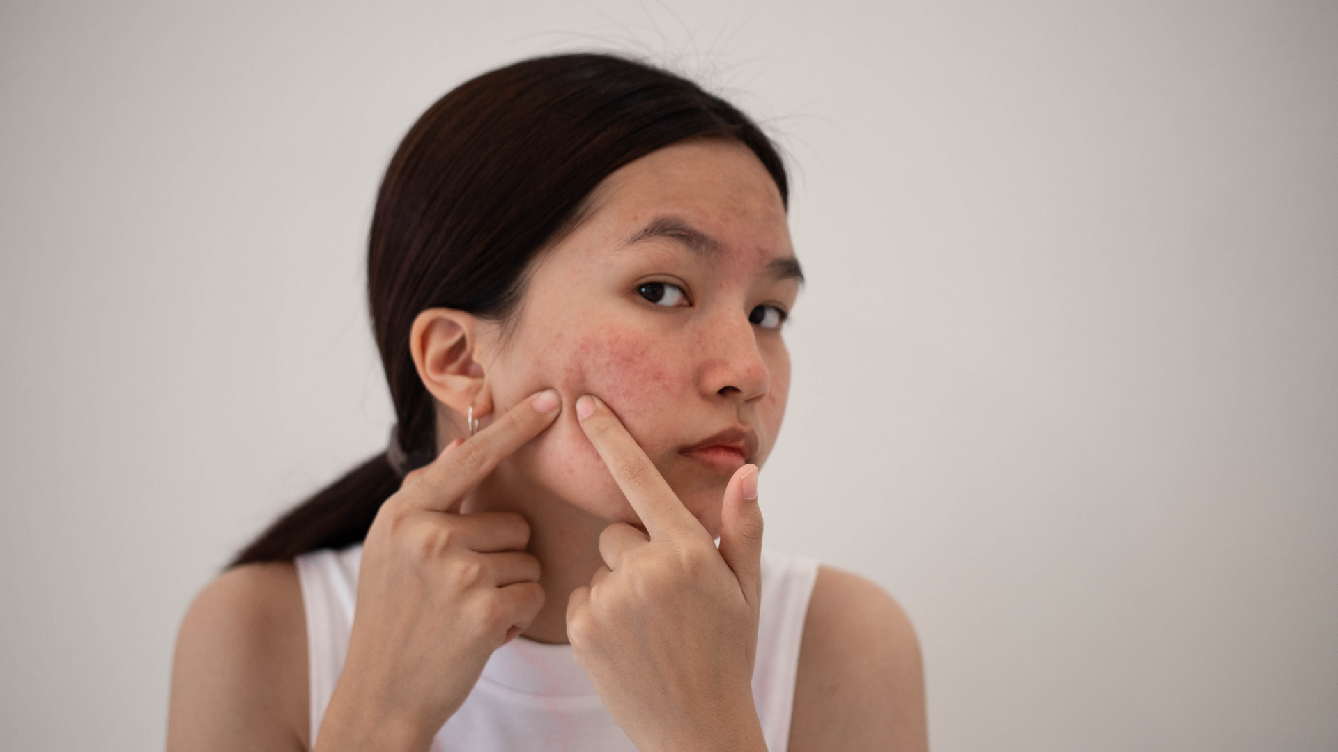 Cách trị mụn nhọt bằng tỏi: Hiểu đúng để sử dụng hiệu quả và an toàn 3