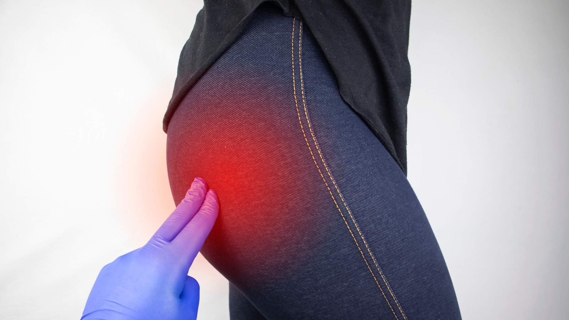 Cách trị mụn nhọt ở hậu môn an toàn và hiệu quả bạn nên biết 2