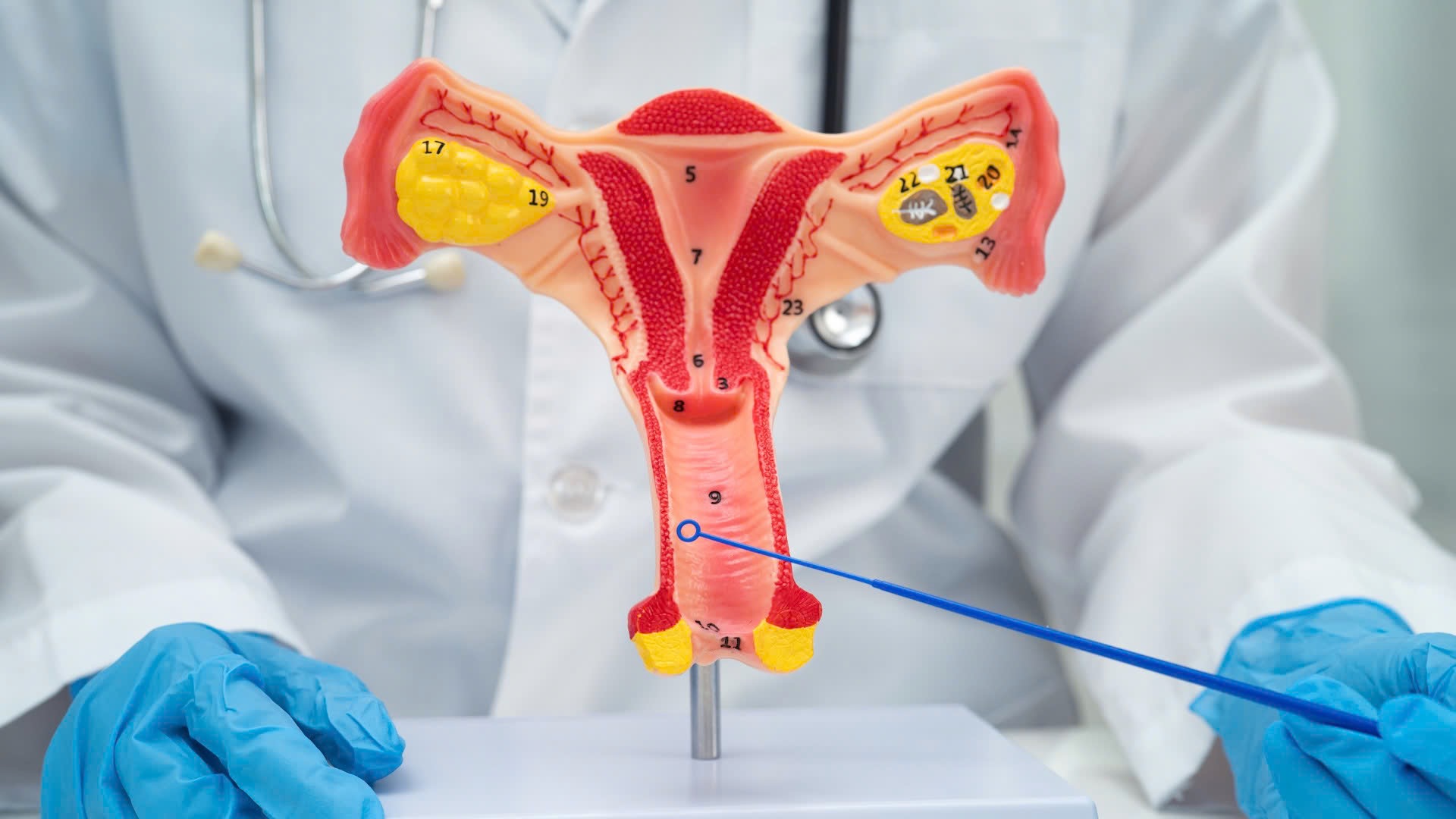 Thói quen đơn giản có thể giúp hạn chế tình trạng ngứa vùng kín tái diễn