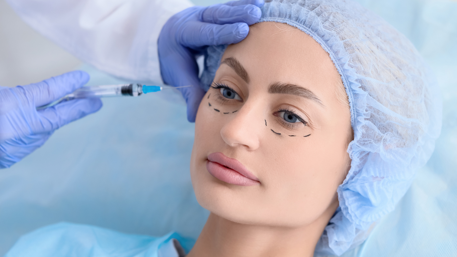 Phẫu thuật tạo hình mí mắt