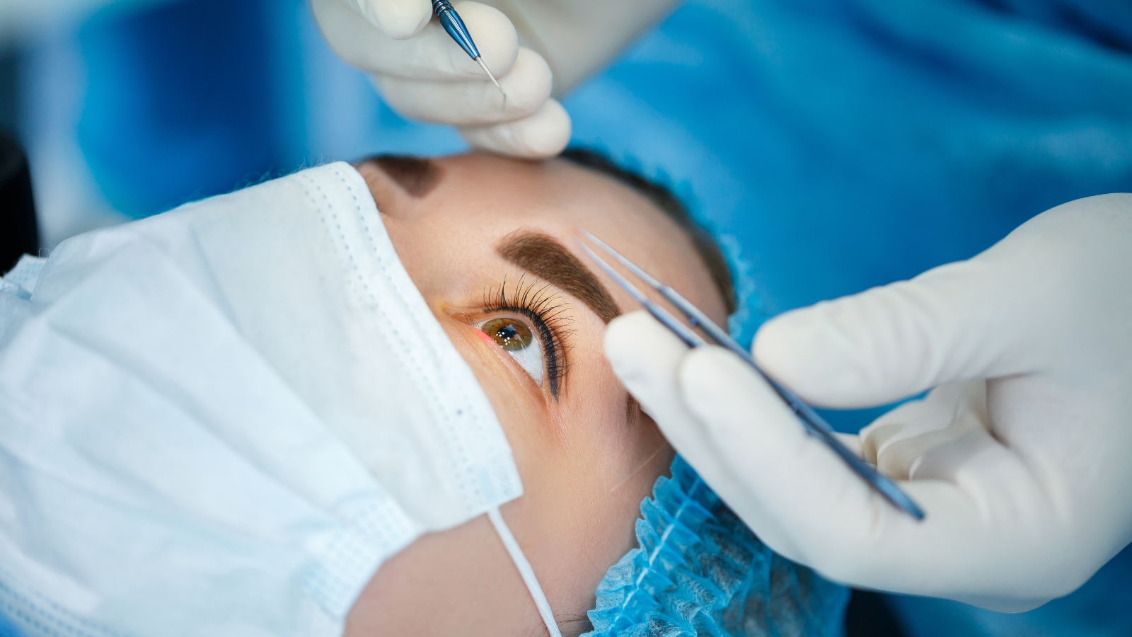 Phẫu thuật nội nhãn cho độ cận cao