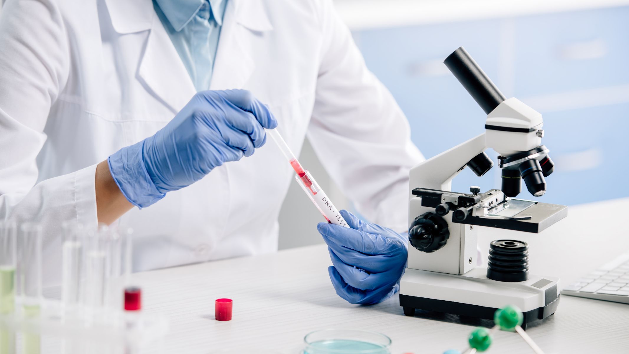 Thực hiện xét nghiệm vi sinh để phát hiện sự hiện diện của vi khuẩn, virus hoặc nấm gây bệnh