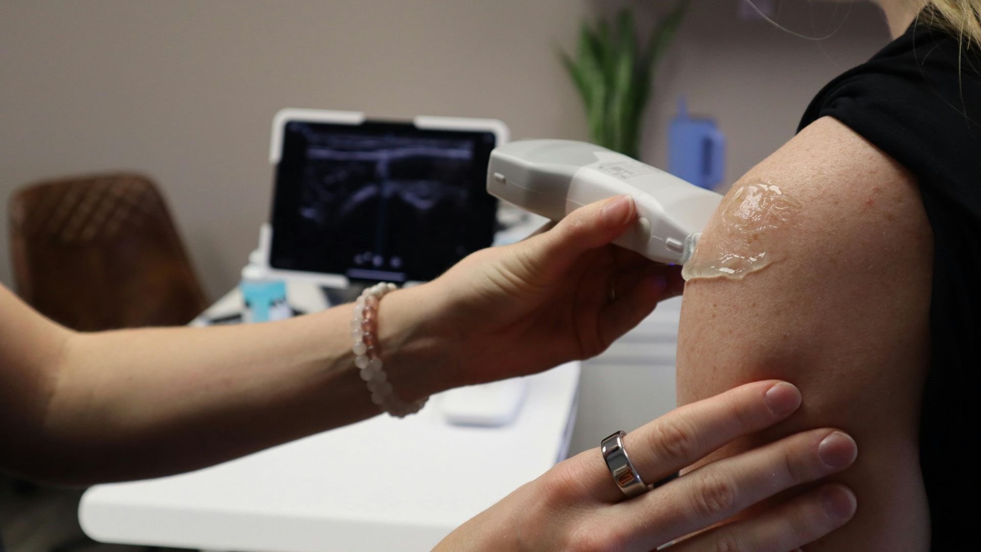 Siêu âm cơ giúp bác sĩ đánh giá chính xác mức độ tổn thương cơ bắp