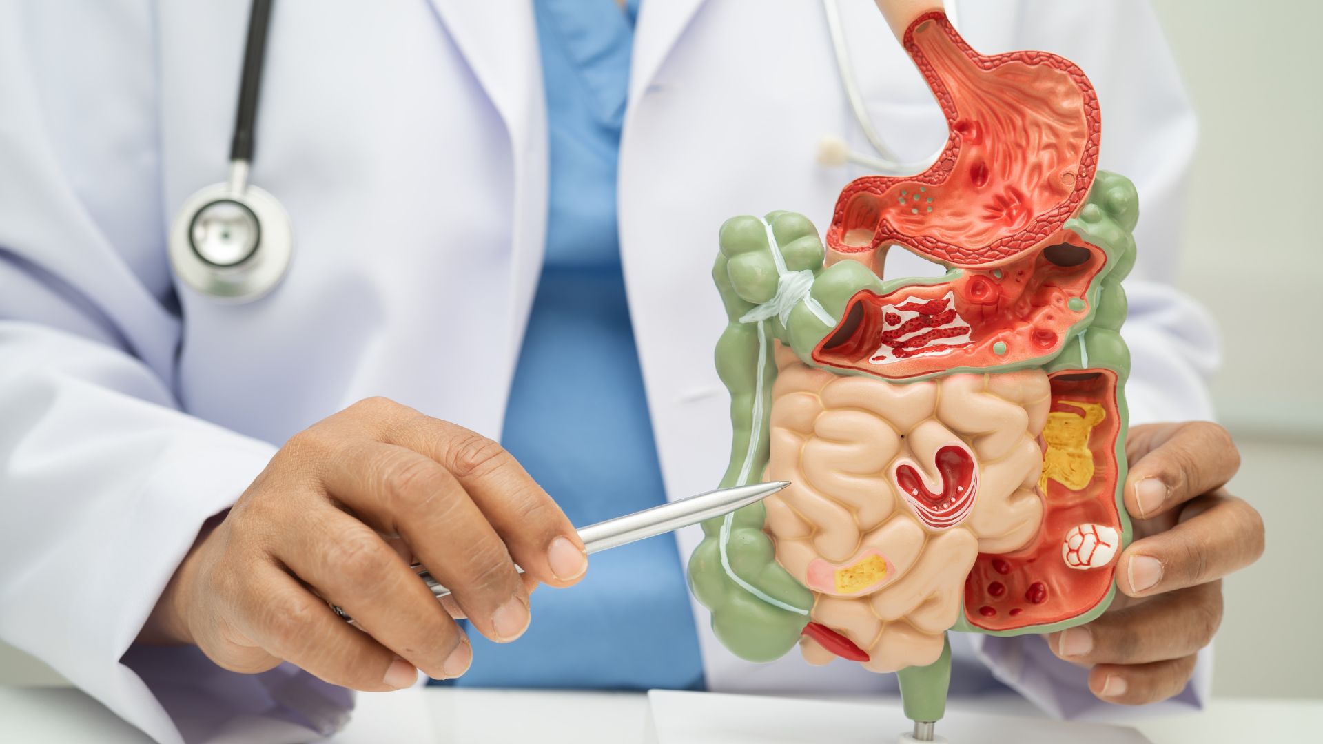 Canxi citrate phù hợp với mẹ bầu có hệ tiêu hóa yếu