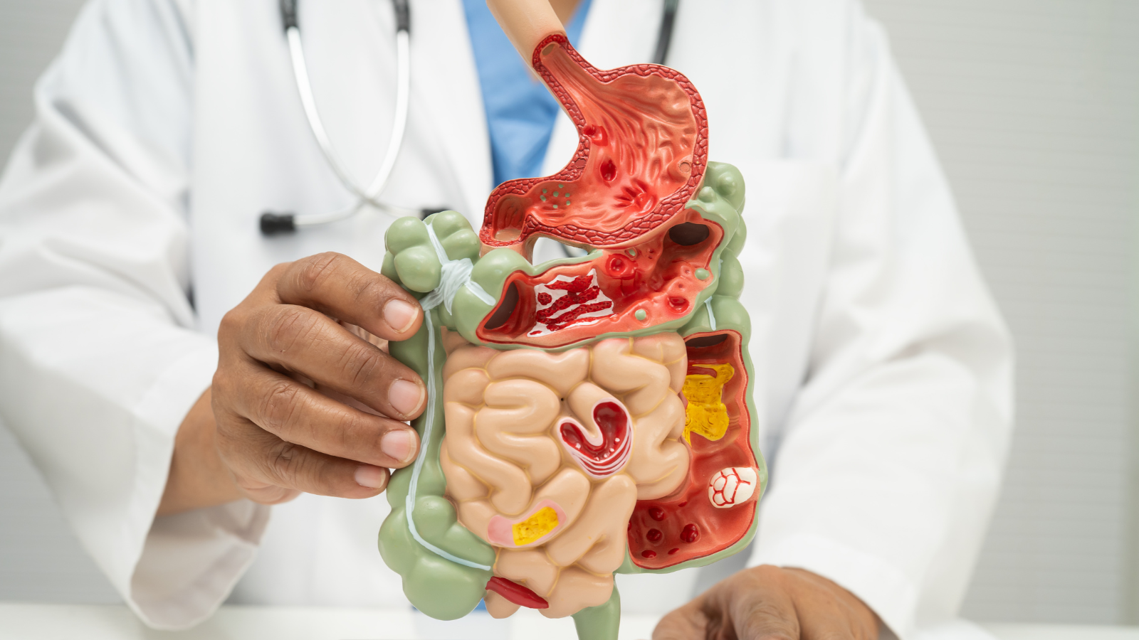 Theo dõi biến chứng tạng đặc là ưu tiên hàng đầu khi gãy xương sườn dưới