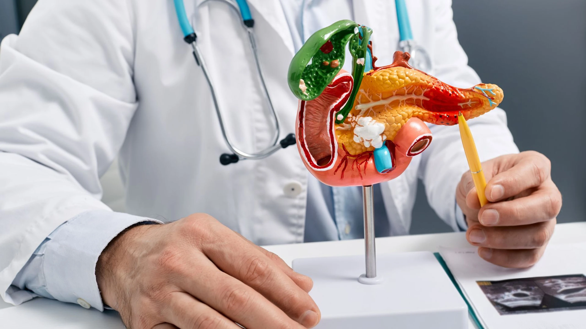Cắt túi mật nội soi mang lại hiệu quả điều trị an toàn cho người bệnh 3