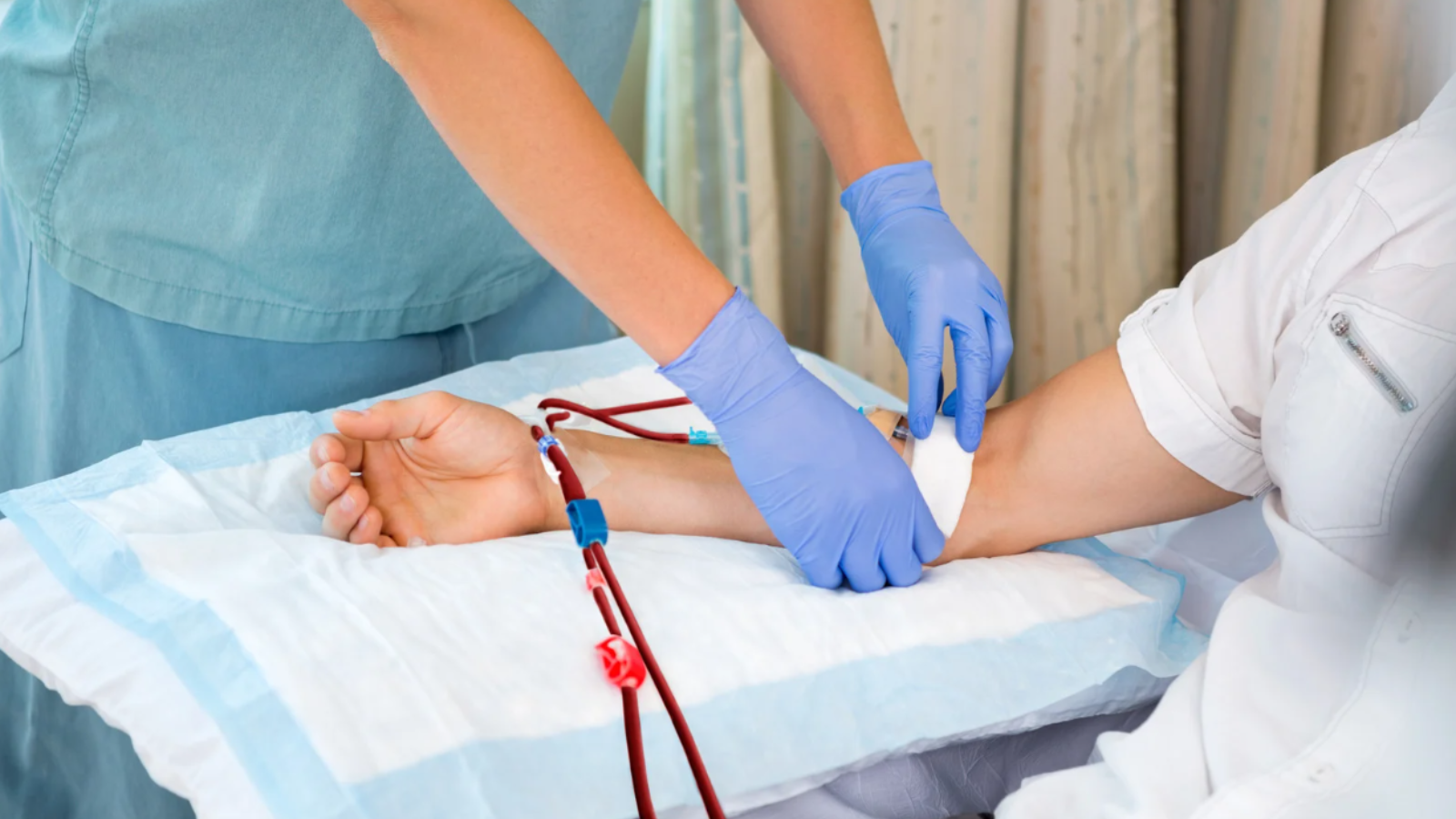 Cầu tay chạy thận và những điều cần biết 1