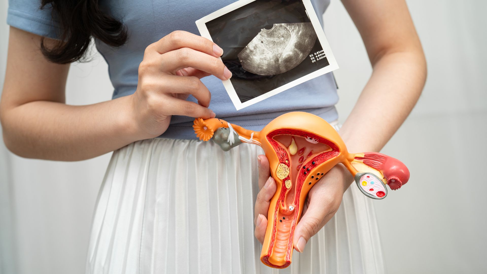 Chậm kinh 10 ngày thai đã vào tử cung chưa? Hãy xét nghiệm hCG và siêu âm để biết vị trí thai chính xác