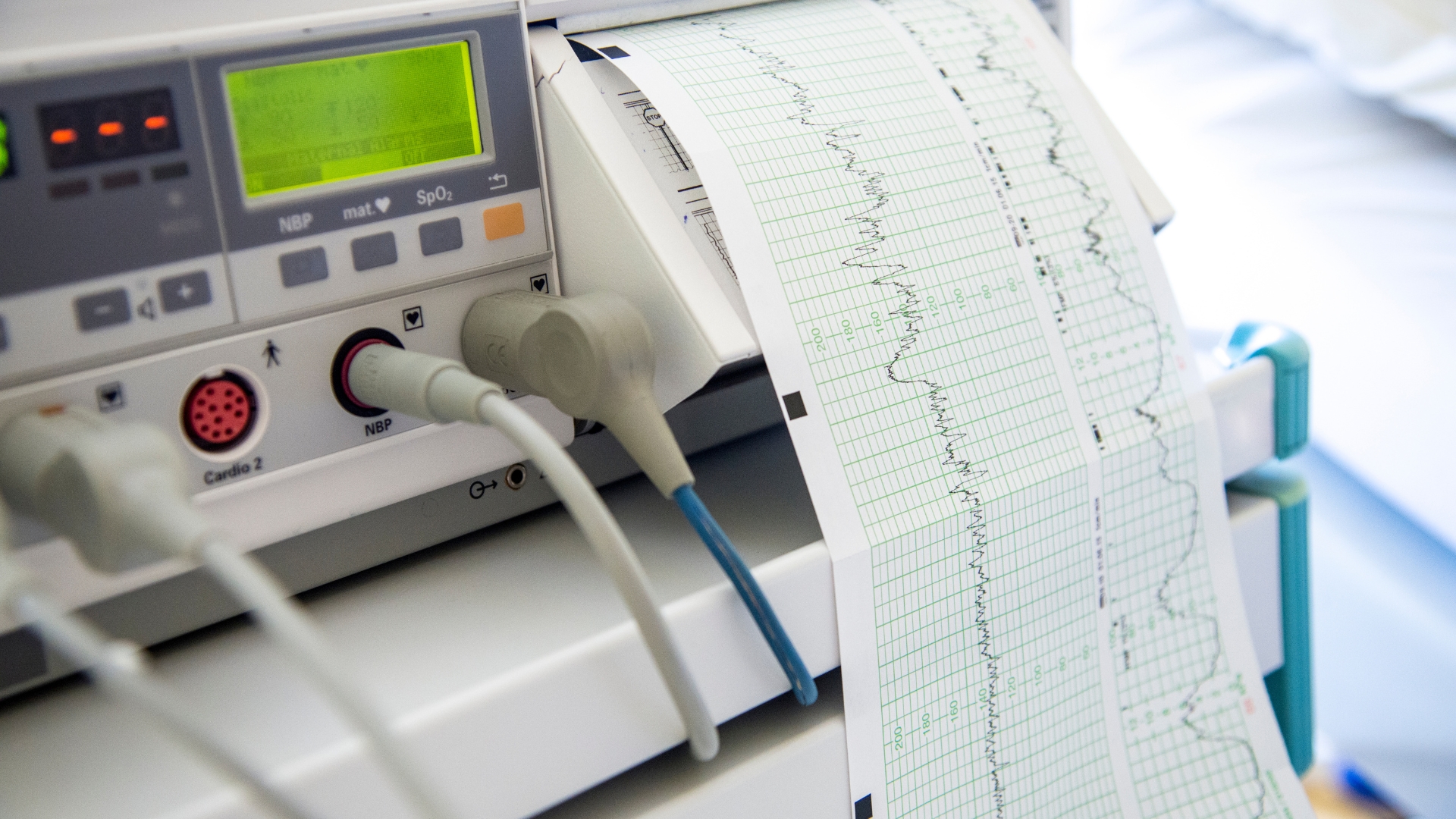 Các phương pháp chẩn đoán nhồi máu cơ tim mà bạn nên biết 3