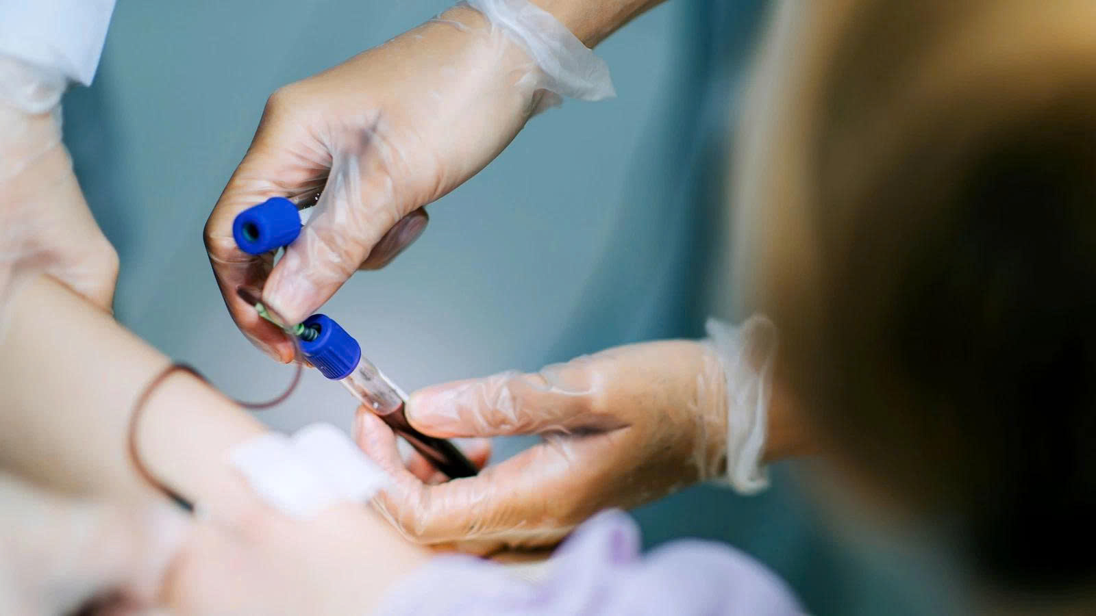 Xét nghiệm máu giúp đo BNP hoặc NT-proBNP để đánh giá mức độ suy tim