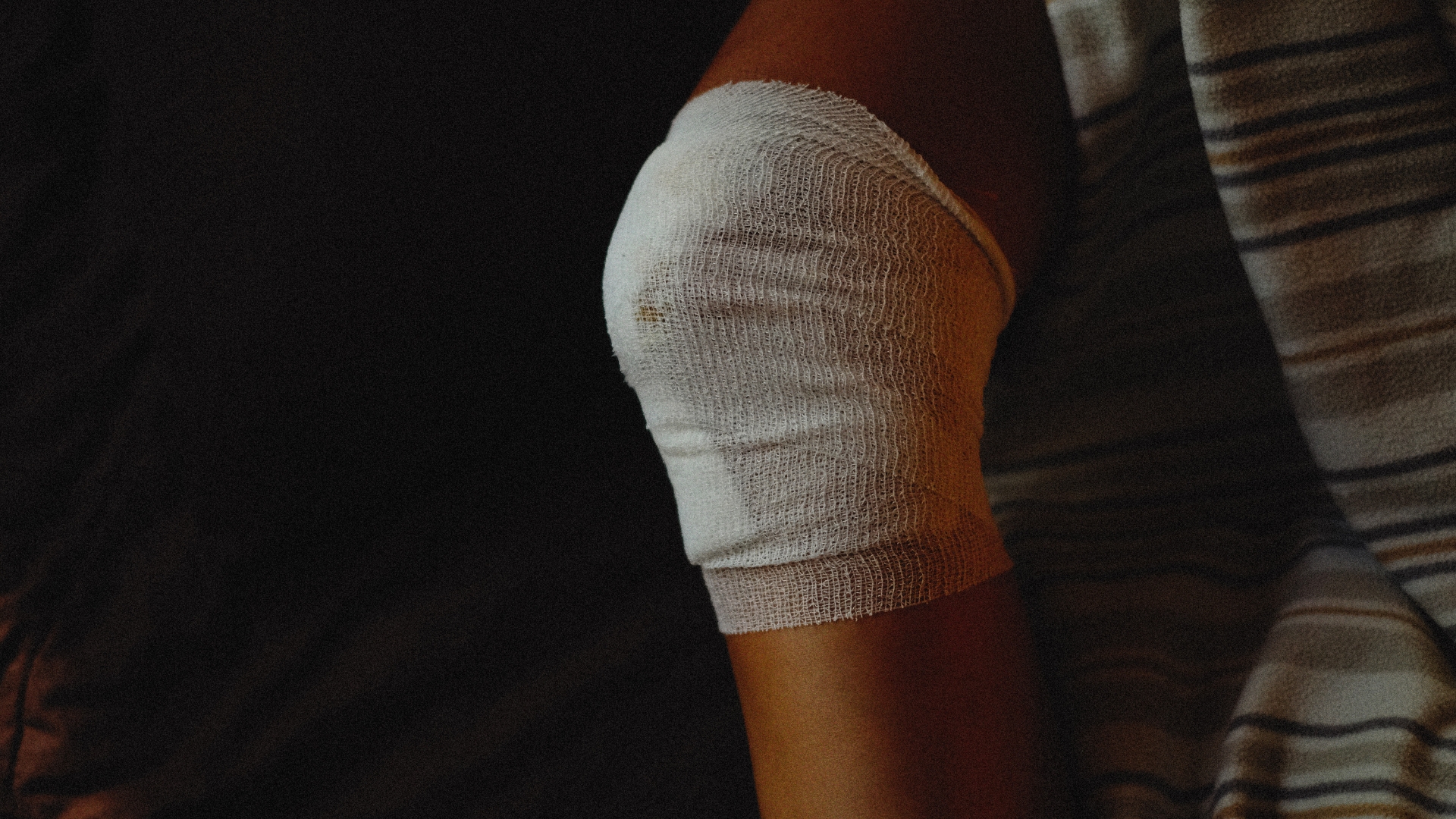 Quấn băng thun quanh đầu gối để cố định và giảm sưng, kê chân cao hơn mặt đất giúp máu lưu thông tốt hơn để giảm ứ đọng dịch và sưng nề