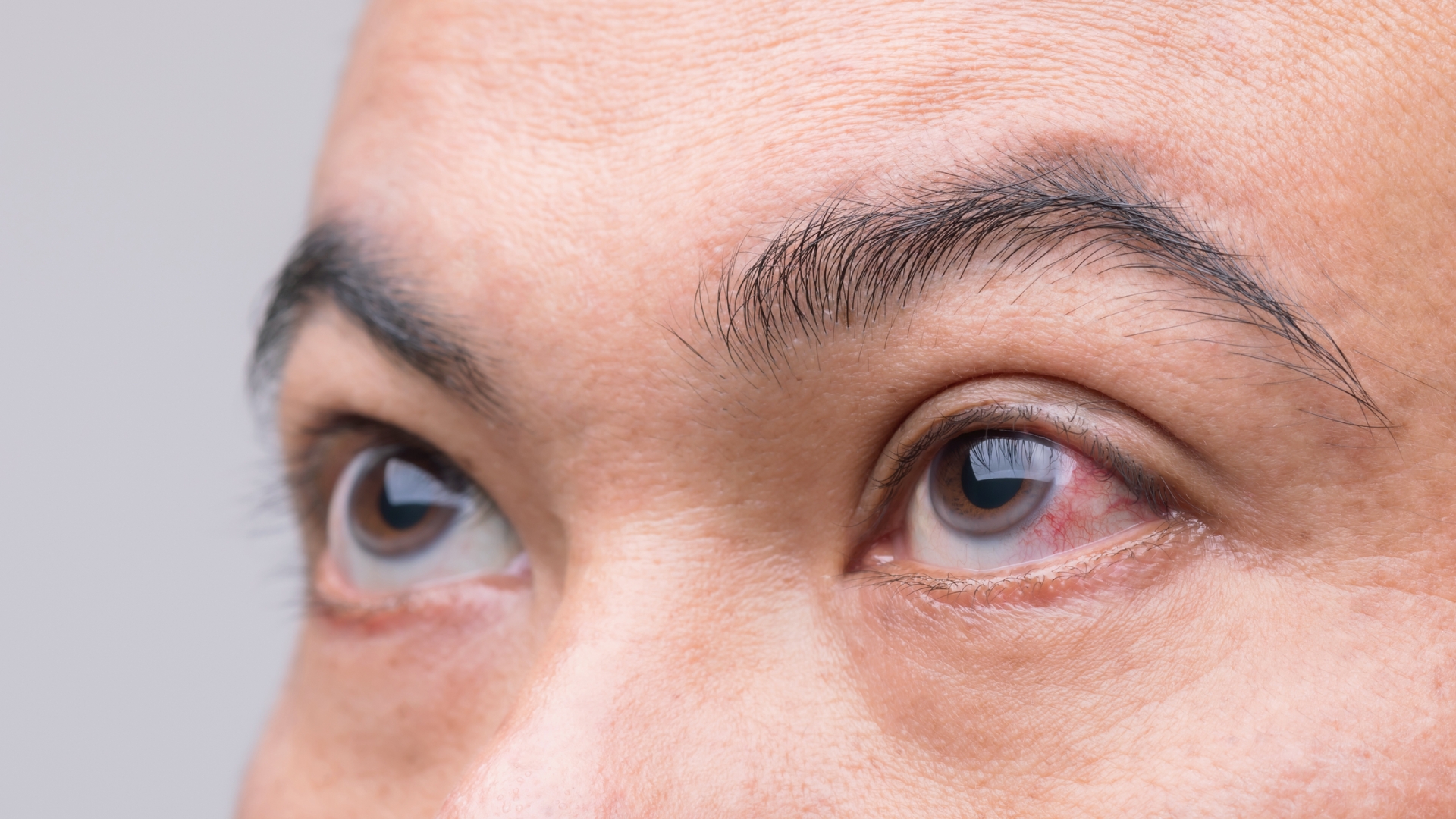 Sử dụng vật sắc nhọn như dao, kéo, que nhọn mà không cẩn thận có thể vô tình gây tổn thương mắt