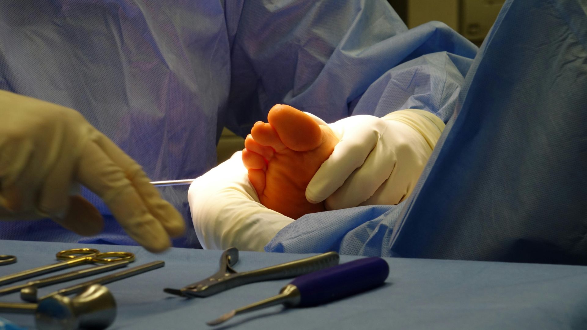 Phẫu thuật chỉnh hình giúp cải thiện chân vòng kiềng nặng