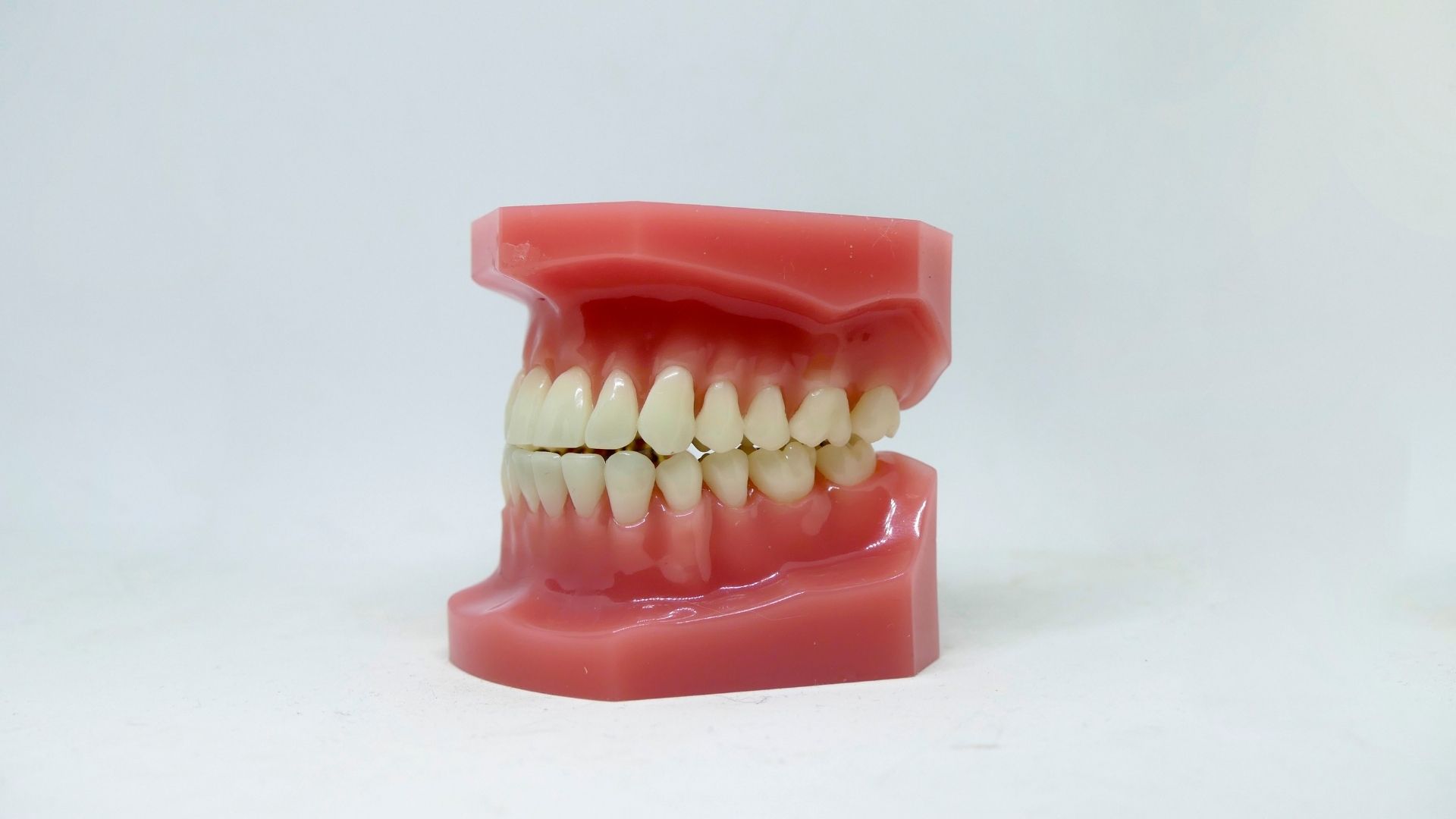 Chảy máu nướu gây tổn thương cấu trúc giữ răng