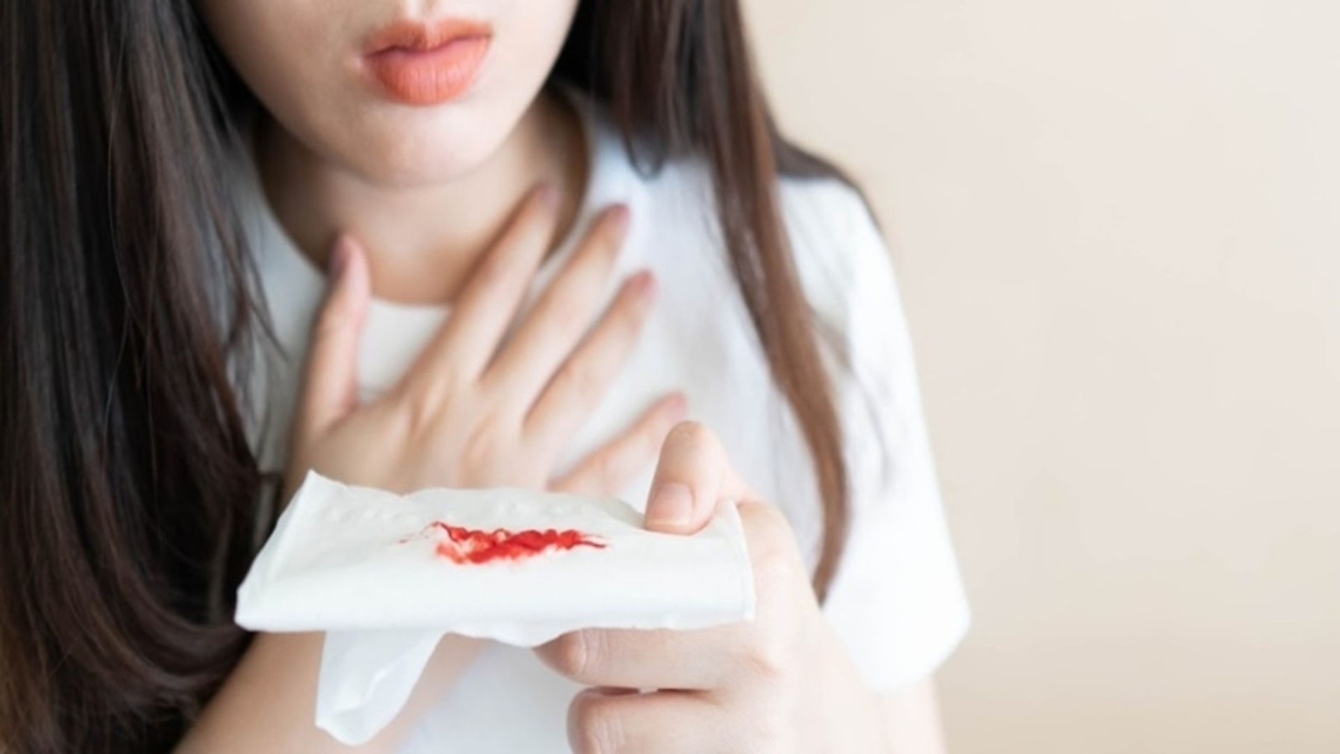 Chảy máu sau cắt amidan là biến chứng cần được đánh giá và xử lý ngay tránh mất máu