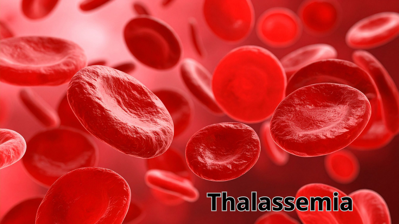 Chế độ ăn cho bệnh nhân thalassemia​ là vấn đề được nhiều người quan tâm